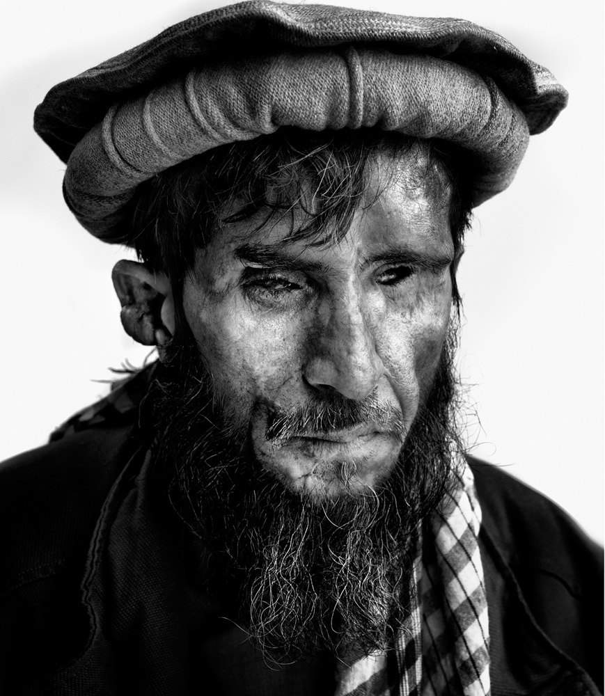 International Mine Action Day: Portraits of Survivors by Marco Grob—Pacha Mir