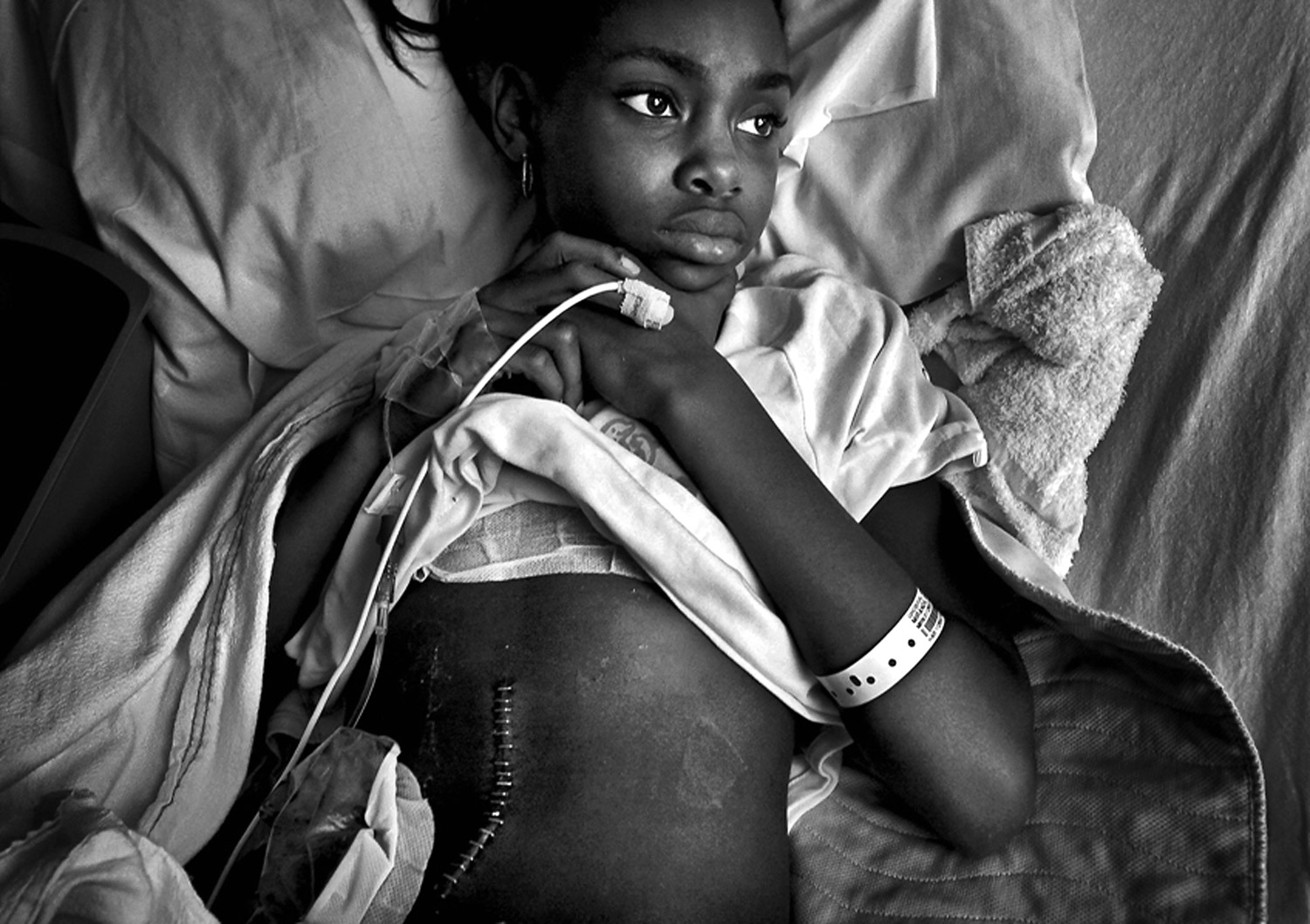 Erica Miranda waits for a bandage change at Long Beach Memorial Children's Hospital. She was shot three times while playing basketball outside her home in Compton, California. This photograph is from the Pulitzer Prize winning series,  Caught in the Crossfire  by the Barbara Davidson of the Los Angeles Times.