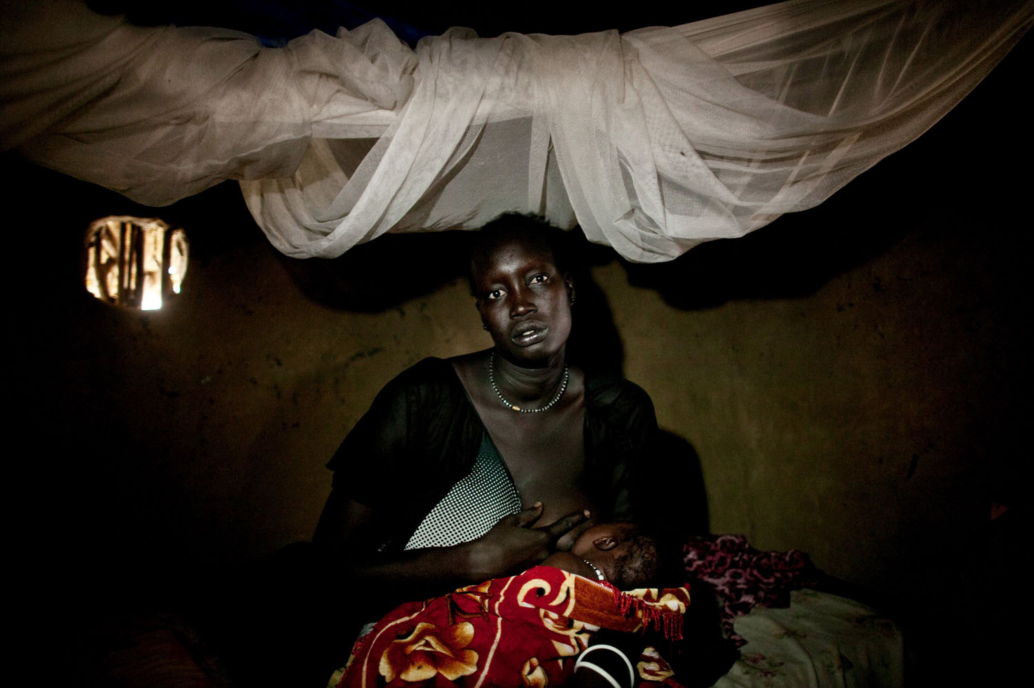 A survivor of a massacre in Fangak, southern Sudan on Thursday, April 7, 2011. The massacre occurred when forces loyal to rebel General George Athor attacked the to town of Fangak on Feb 9th and 10th, 2011. When the fighting ended, more than 200 people were dead, many of whom were civilians.