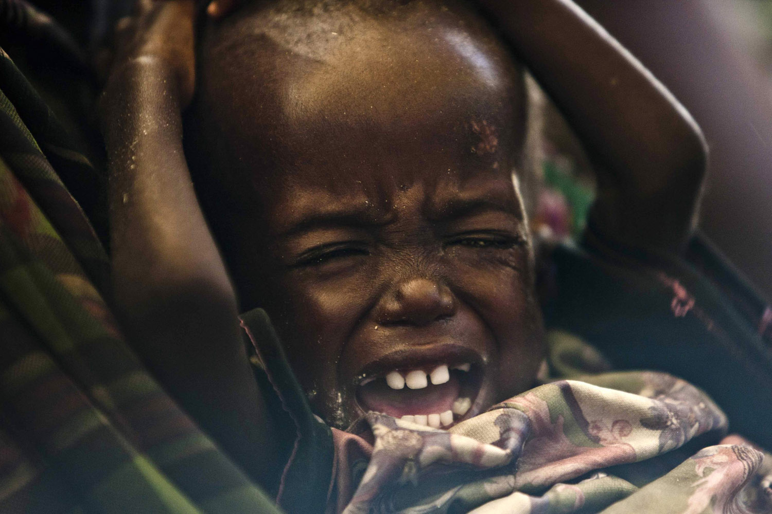 August 8, 2011. Lokor Logitel, a three-year-old girl, cries at  the Mukutano feeding centre in Naduat Village, northwest of Kenya's capital Nairobi. The famine in the Horn of Africa is spreading and may soon engulf as many as six more regions of the lawless nation of Somalia.