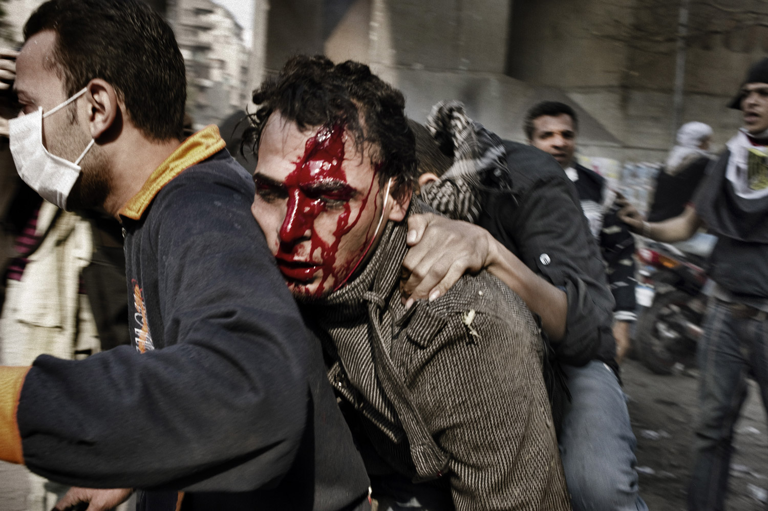 A severely wounded protester is evacuated by other demonstrators during clashes, November 23, 2011.