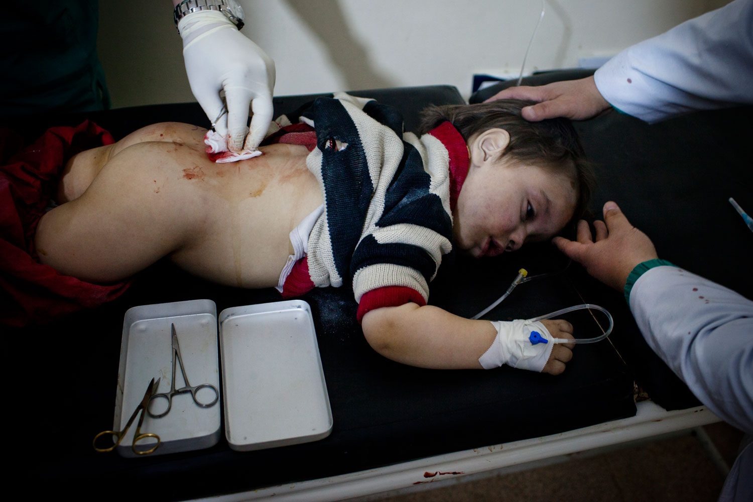 Feb. 24, 2012. A baby wounded by a mortar attack at the Bab Amr clinic. The boy died a few days later.