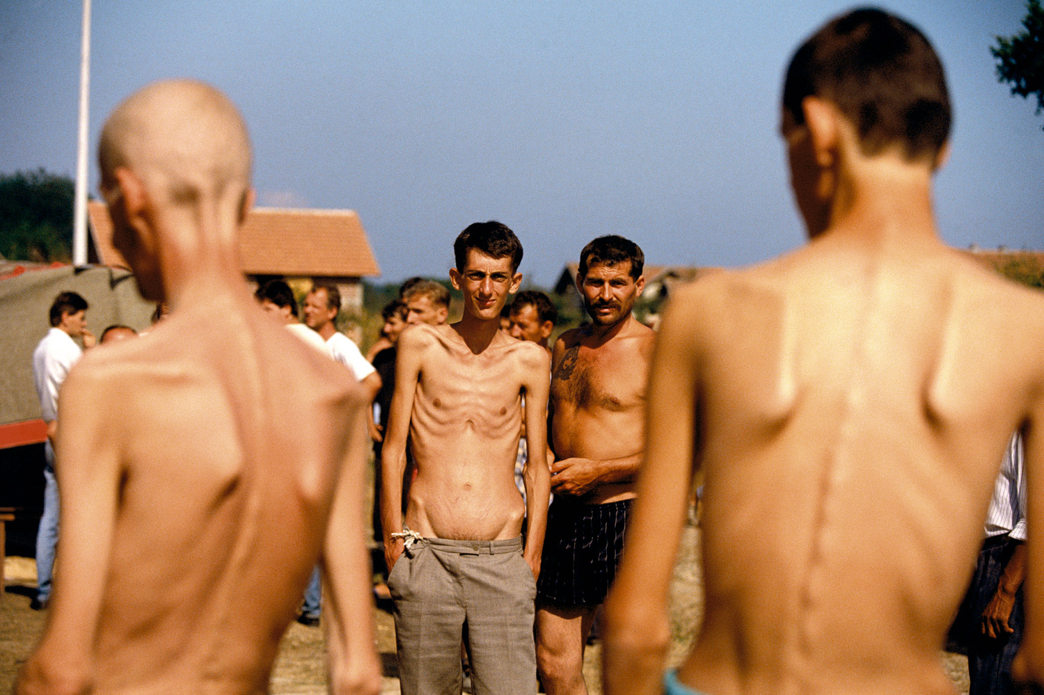 August 1992. Trnopolje. When several journalists broke the story of the Serbian prison camps, there was a huge outcry in the world. Immediate comparisons to Nazi concentration camps were invoked and a demand for investigations and intervention were discussed. I was working on the Bosnian Serb side at the time trying to understand the war from their perspective as, like all wars, nothing is completely one-sided. However it was extremely difficult to work as it appeared the Bosnian Serbs didn't understand or care about journalism and the flow of information even when it was to help people understand them.I asked a Bosnian Serb Army officer if I could go to a front line near where they had recently lost ground and show the effects on their civilian population. He quickly said no but said if I wanted I could go to visit the prison camps in order to see they really weren't as bad as people thought.To this day I am not sure if the Bosnian Serb leadership made a brilliant short-term public relations move or just created a long-term accusatory piece of evidence. After my trip to several camps, TIME published the images and the outcry was as to be expected. Brutal images harking back to World War II but now in color and in the 1990s were shocking to all. But the shock quickly wore off and people really didn't care. Some camps were closed while new ones on all sides opened and the story in the immediate sense disappeared. But now 20 years later we are reminded what happened again in the heart of Europe while we all watched.