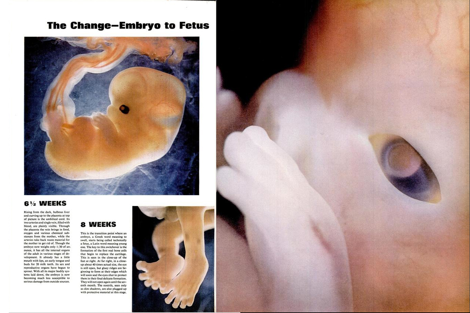 Page spreads from the Lennart Nilsson photo essay, "Drama of Life Before Birth," in the April 30, 1965, issue of LIFE magazine.