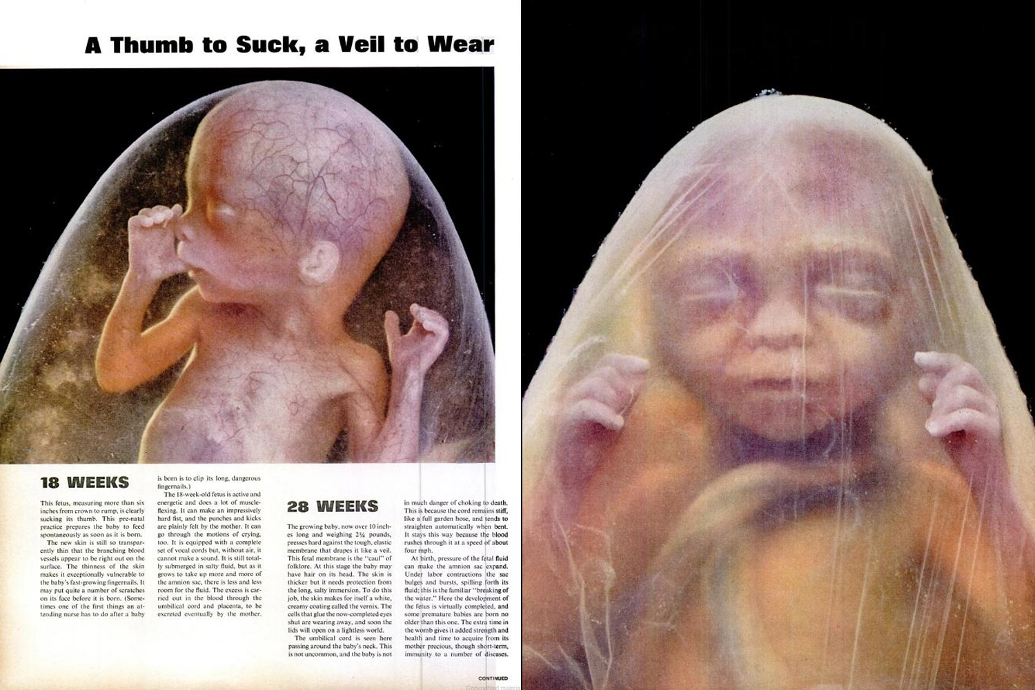 Page spreads from the Lennart Nilsson photo essay, "Drama of Life Before Birth," in the April 30, 1965, issue of LIFE magazine.