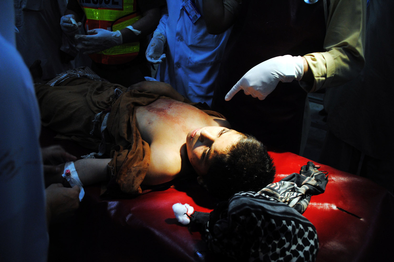 June 12, 2012. An injured boy receives medical treatment at a hospital in northwest Pakistan's Peshawar. At least two people were killed and several others injured when a bomb exploded in Peshawar on Tuesday, local media reported.
