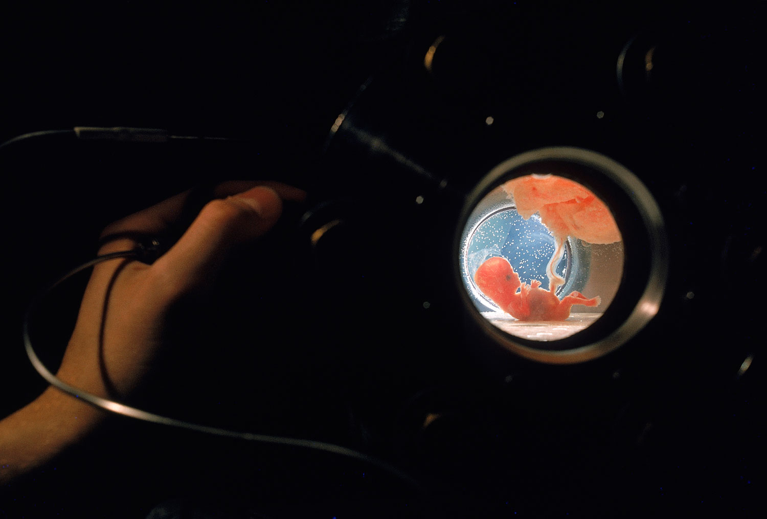Seen through porthole, a fetus, attached by umbilical cord to placenta floating above it, gets oxygen through skin from surrounding fluid. Hand at left is adjusting valve to let in nutrients.