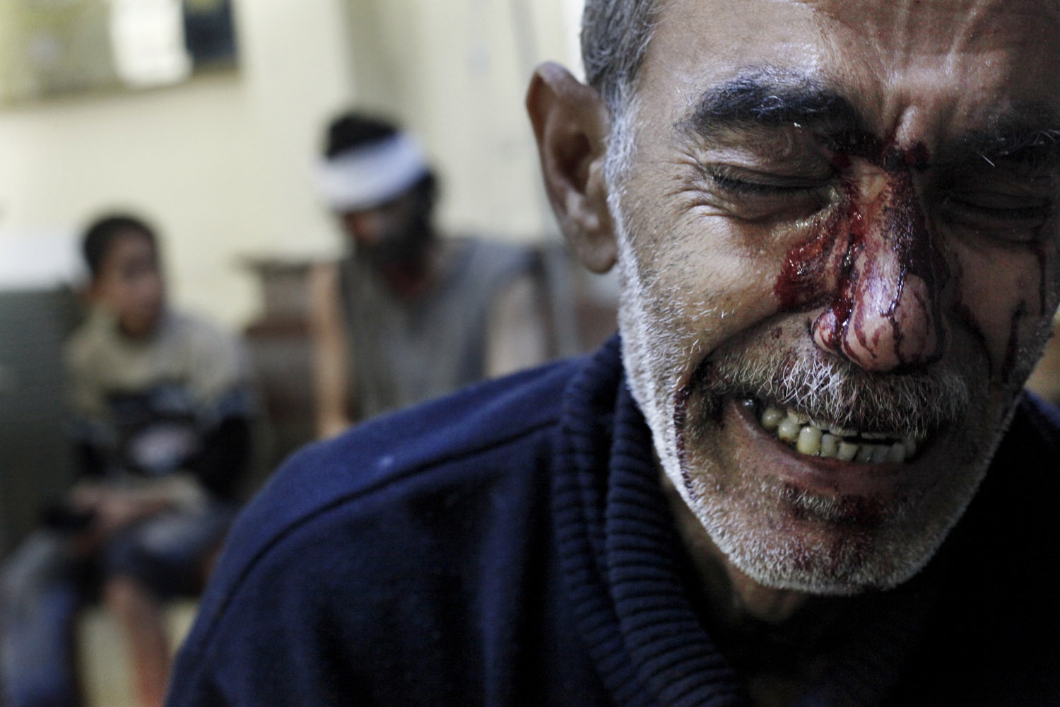 Image: Oct. 31, 2012. Kamal, the father of an 8-year-old girl who was fatally wounded cries while being treated in a local hospital in a rebel-controlled area of Aleppo, Syria.