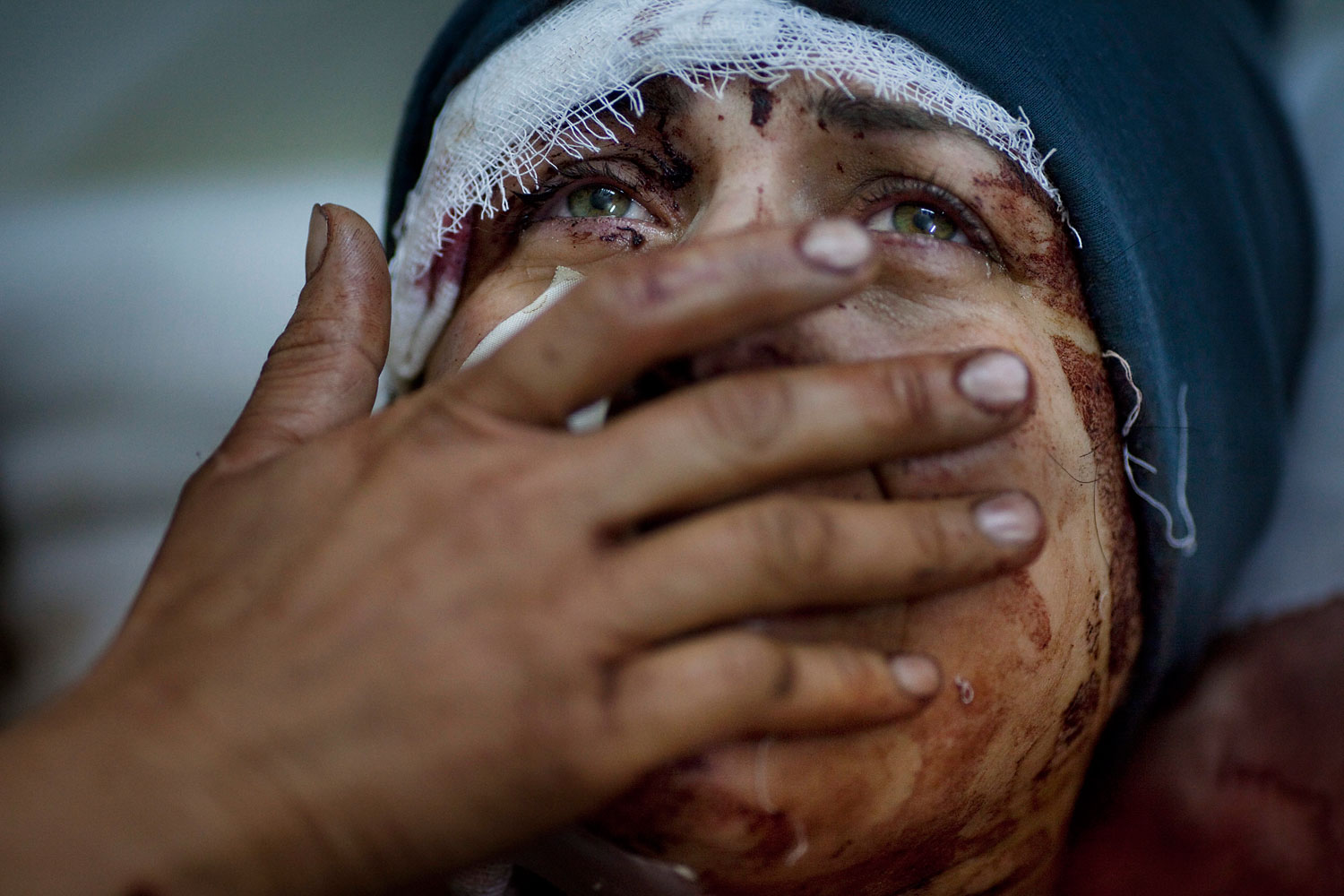 1st Prize General News Single. Rodrigo Abd, Argentina, The Associated Press. 10 March 2012, Idib, Syria. Aida cries while recovering from severe injuries she received when her house was shelled by the Syrian Army. Her husband and two children were fatally wounded during the shelling.