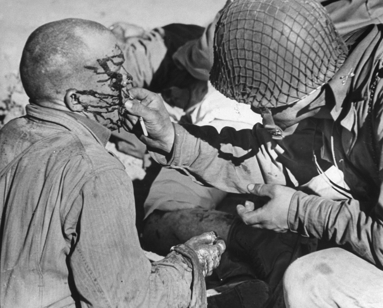 Bespattered with blood and oil after strafing attack by nine Me-109s [Messerschmitts] on first day of battle, a wounded half-track gunner vainly tries to swallow a sulfa tablet. Attending officer subsequently flushed it down his throat with water. Three other men on the half-track were killed.