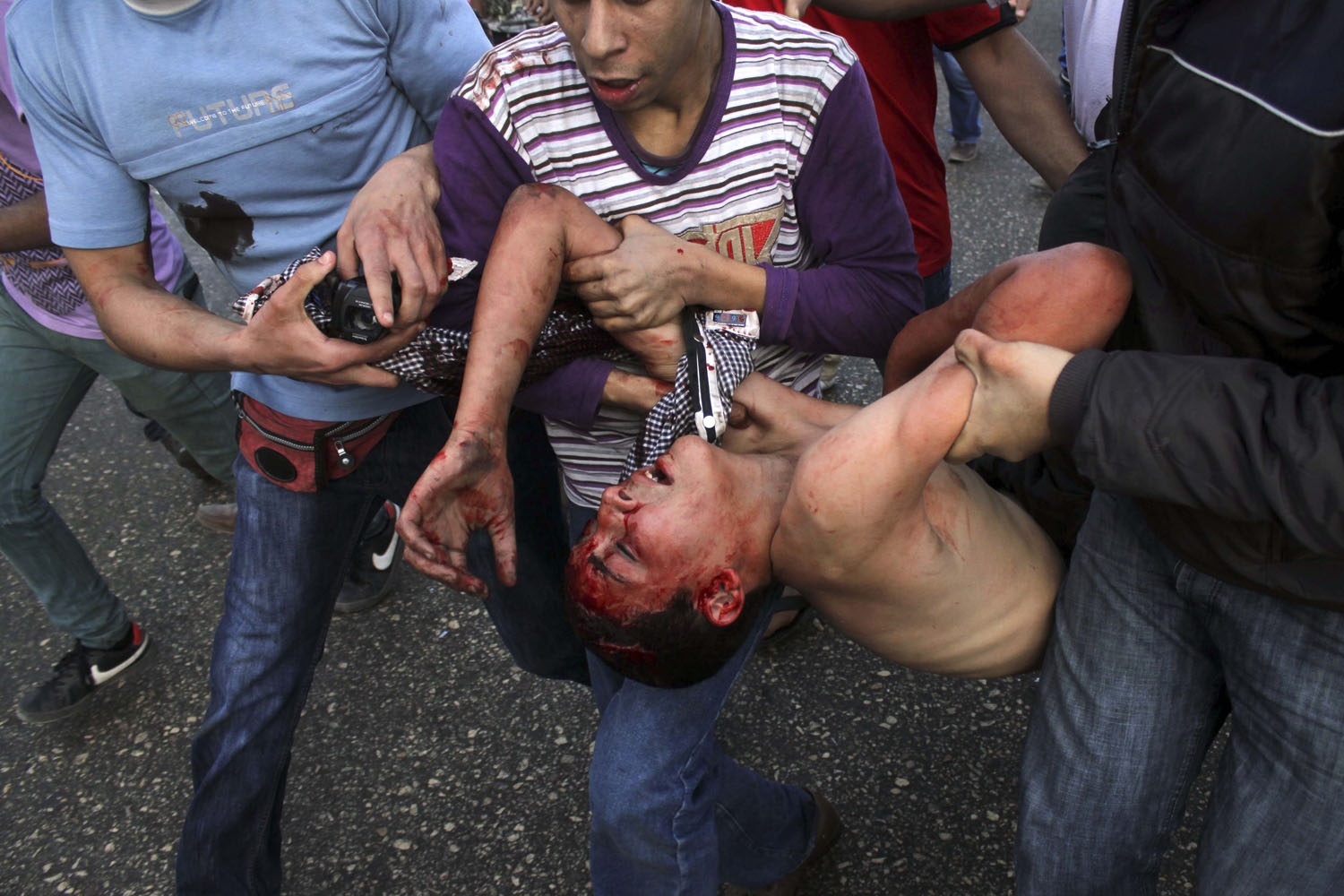 April 19, 2013. A wounded protester is carried in Tahrir Square after being injured in fighting between pro and anti-Muslim Brotherhood supporters in Cairo. Clashes erupted Friday between several hundred opponents and supporters of Egypt's Islamist president during a rally by his allies calling on him to cleanse the judiciary of alleged supporters of the old regime.