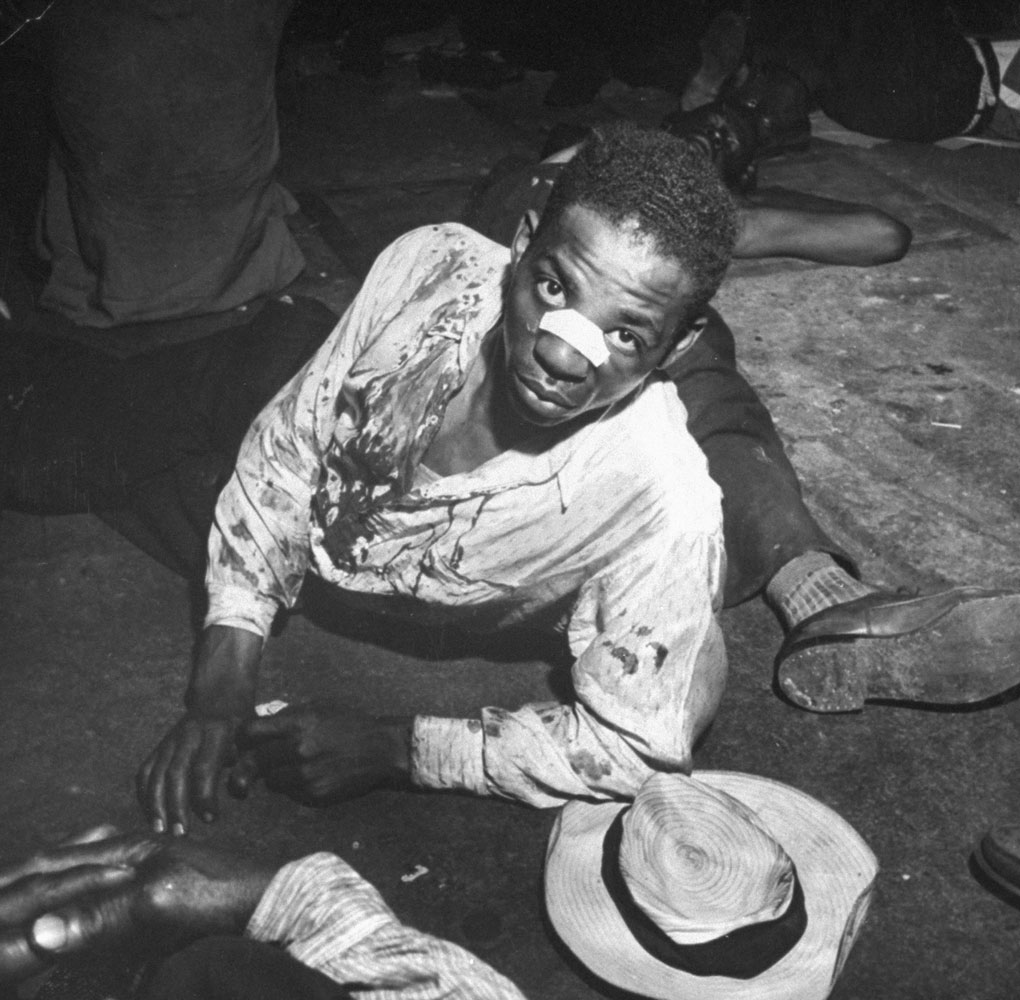 Bloodied African American man who was one of many blacks rounded up following wartime race riots in Detroit, June 1943.