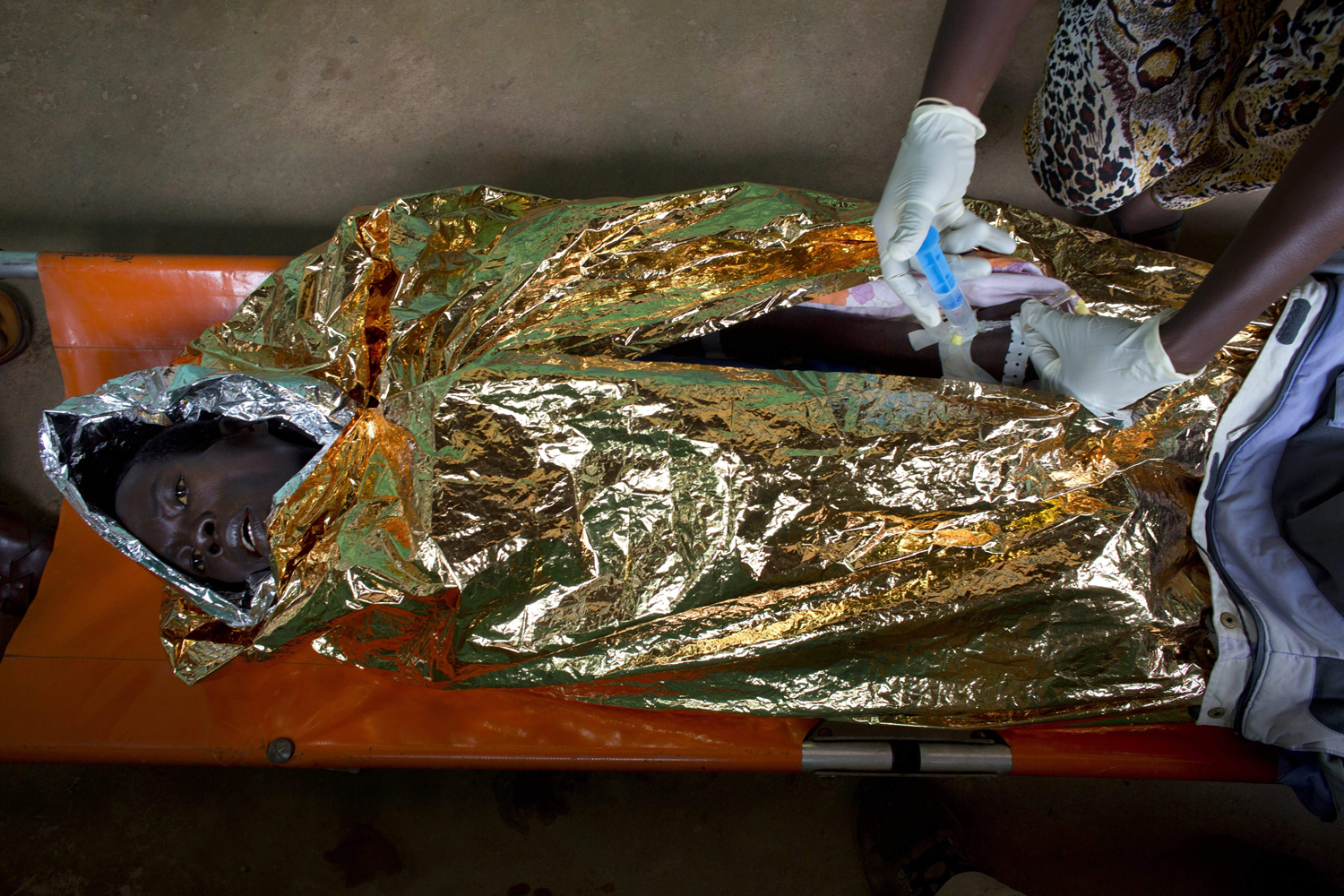 June 27, 2013. Medical personnel wrap aluminum foil around an HIV patient to keep warm in Batangafo, Central African Republic.