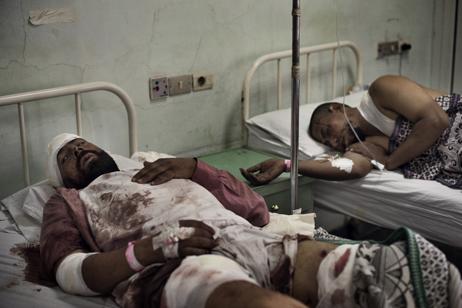 Cairo Egypt July 08 2013: injured Morsi supporters were treated at the hospital.
