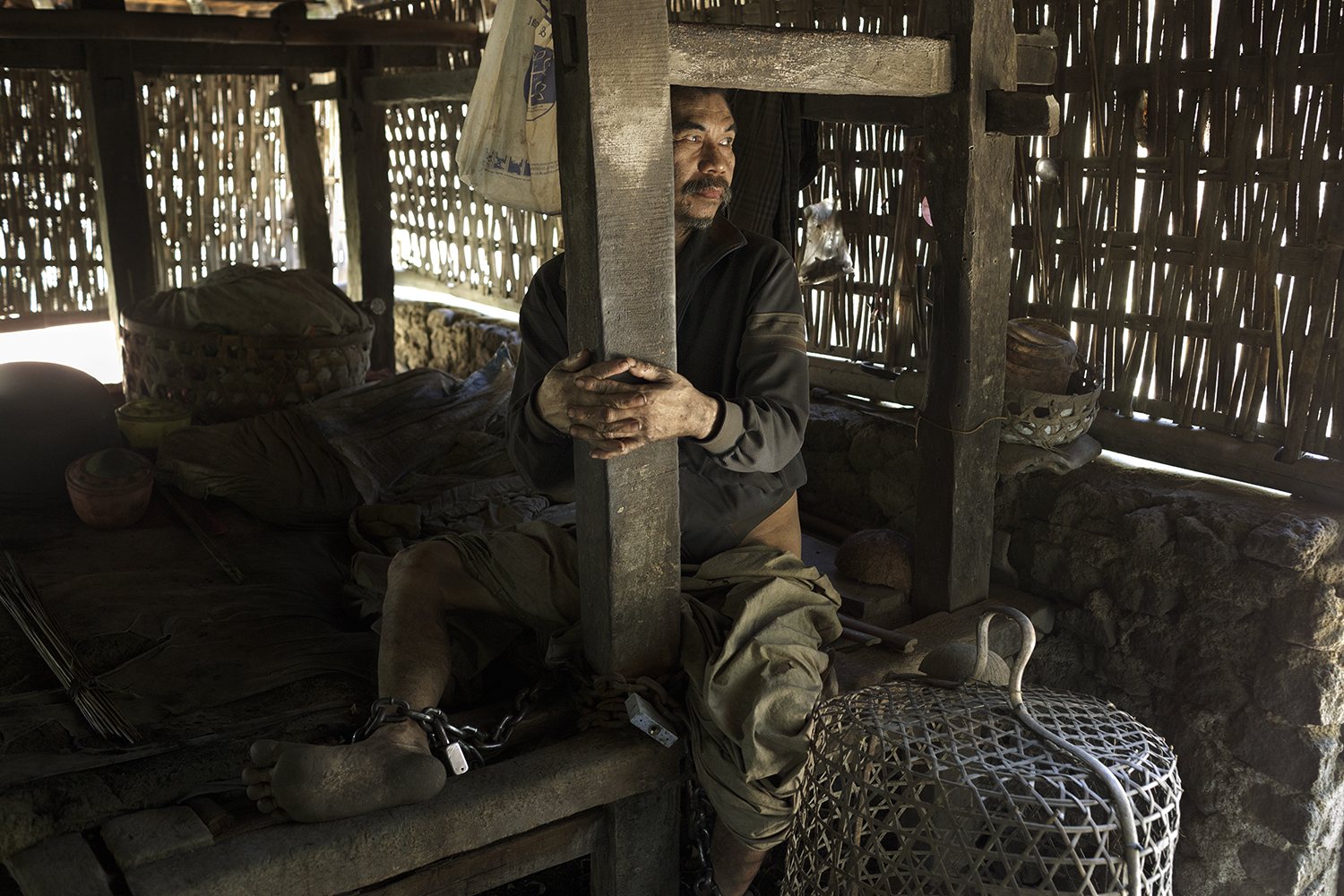 Gede, living chained to a post in a shed behind his mother’s home in a remote area of Bali, was reported to the Suriani Foundation. Dr. Suriani founded one of the rare, perhaps the only, outreach programs in Indonesia involving home visits by a psychiatrist.