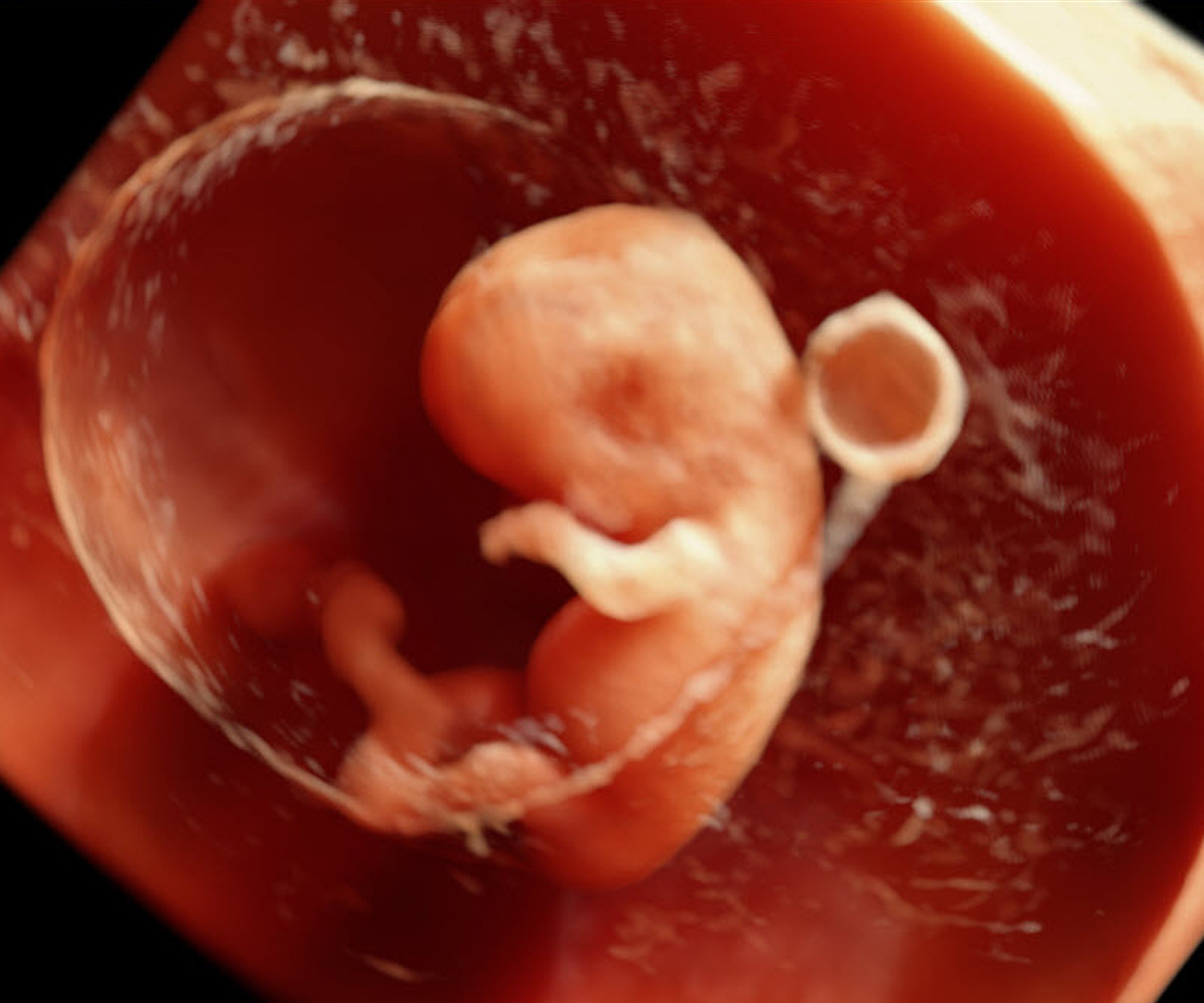 Gestation: 10 weeks.