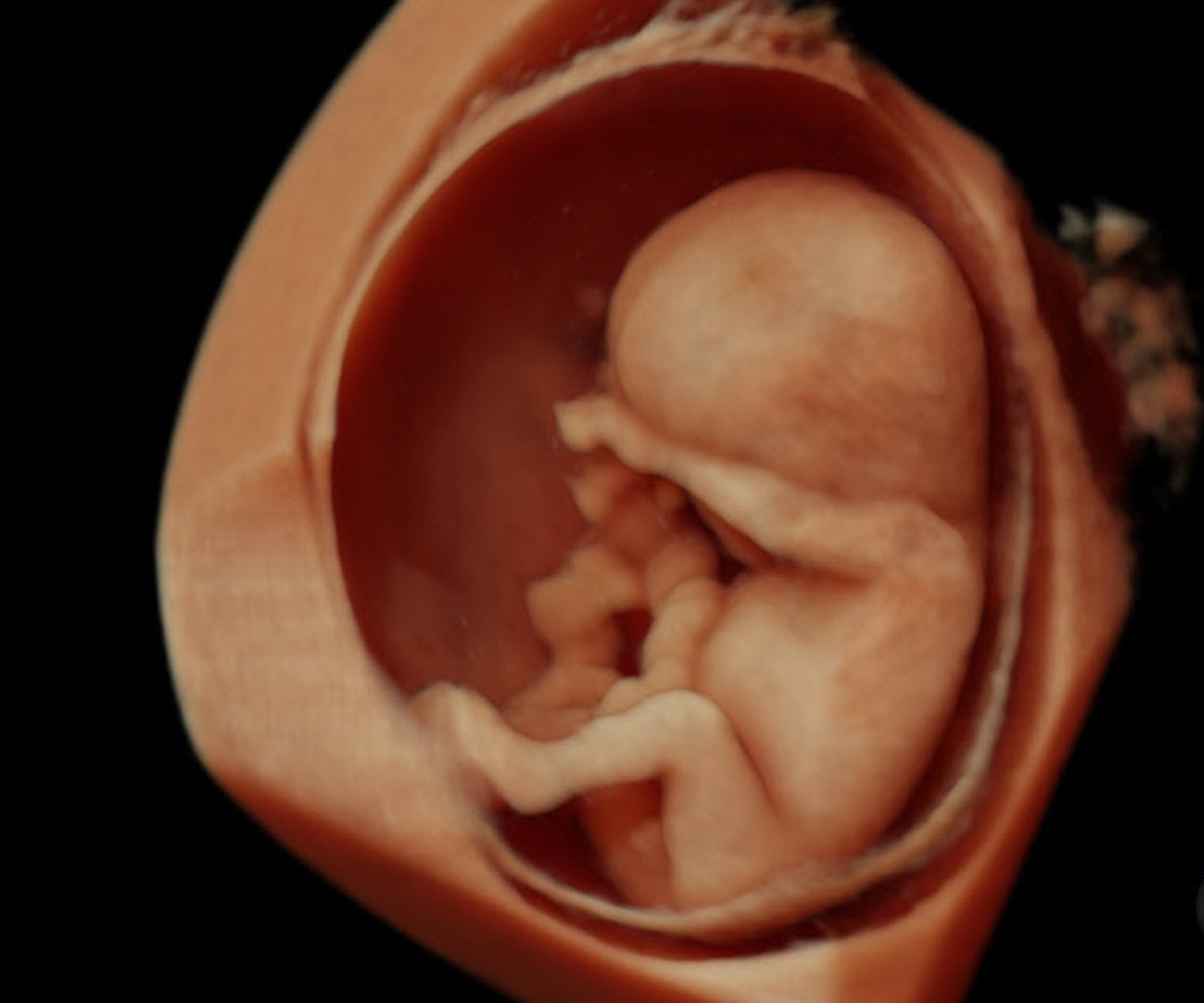 Gestation: 12 weeks.