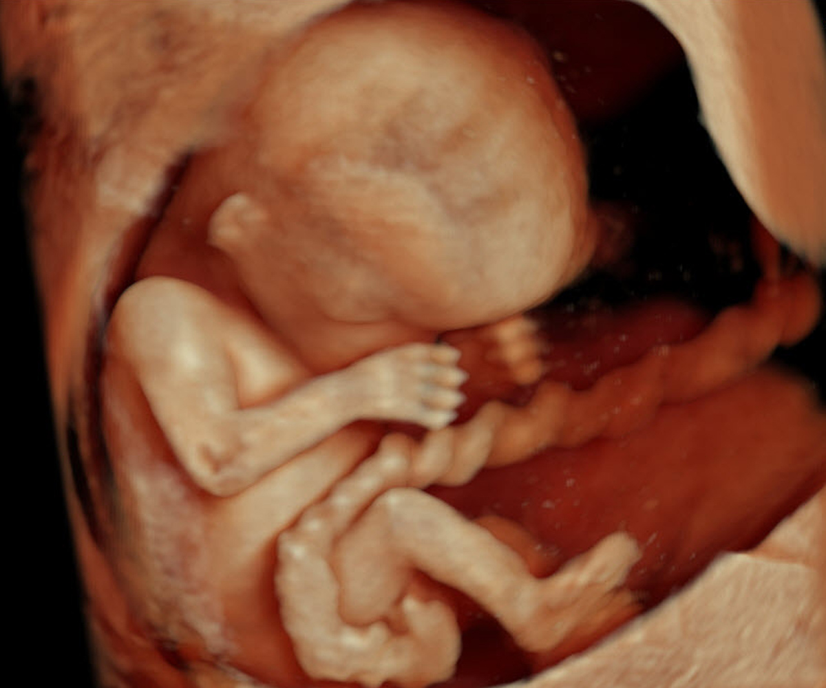 Gestation: 12 weeks.