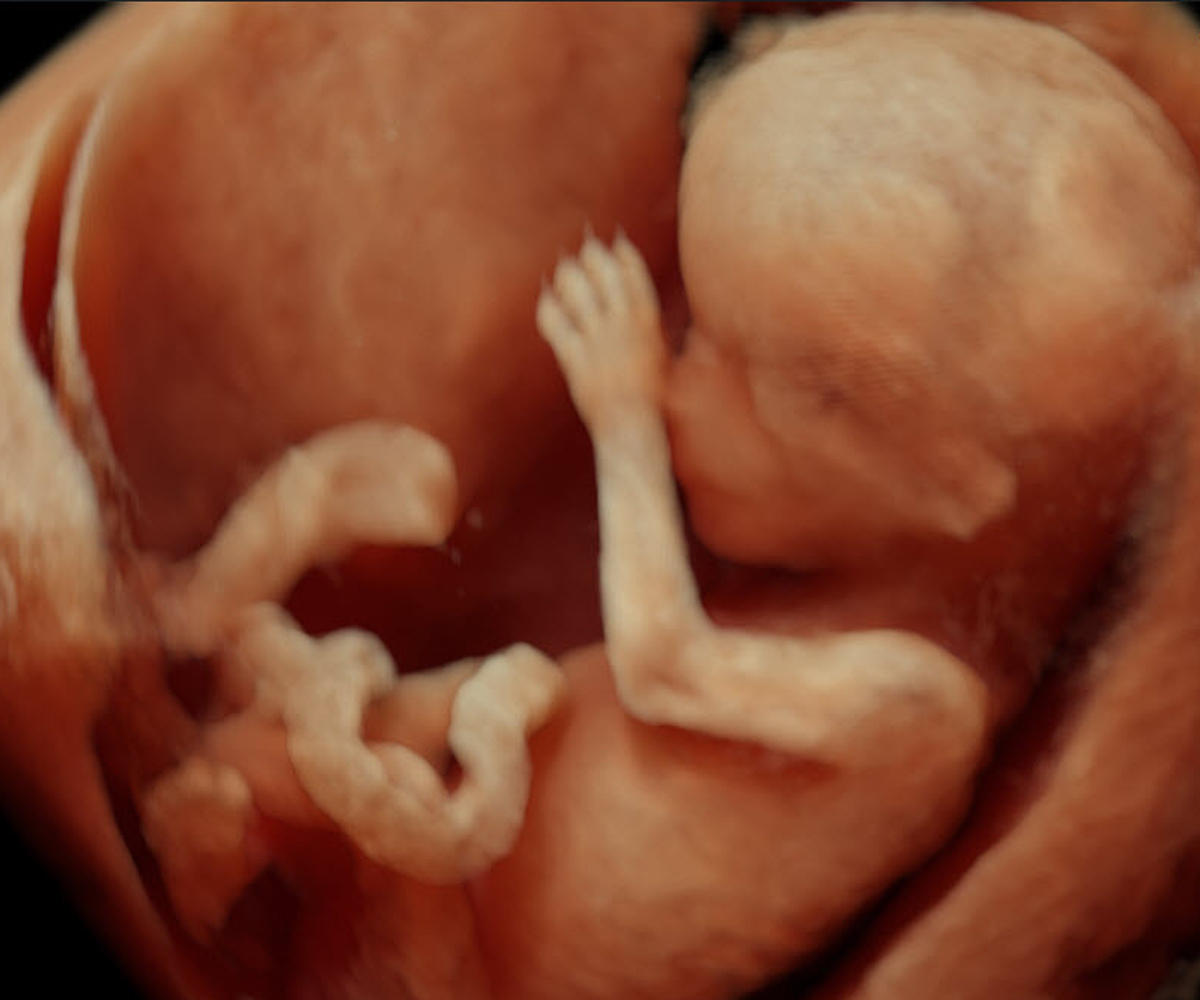 Gestation: 13 weeks.