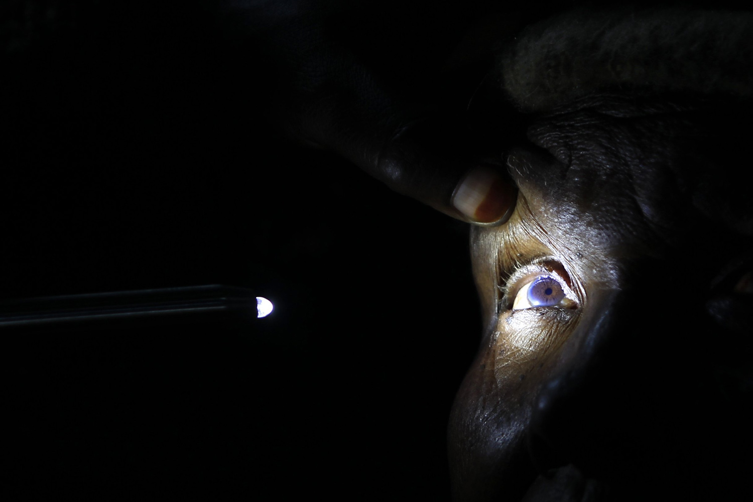 Oct. 29, 2013. An eye attendant examines the eye of a patient at a temporary clinic by International Center for Eye Health at Olenguruone, Nairobi.