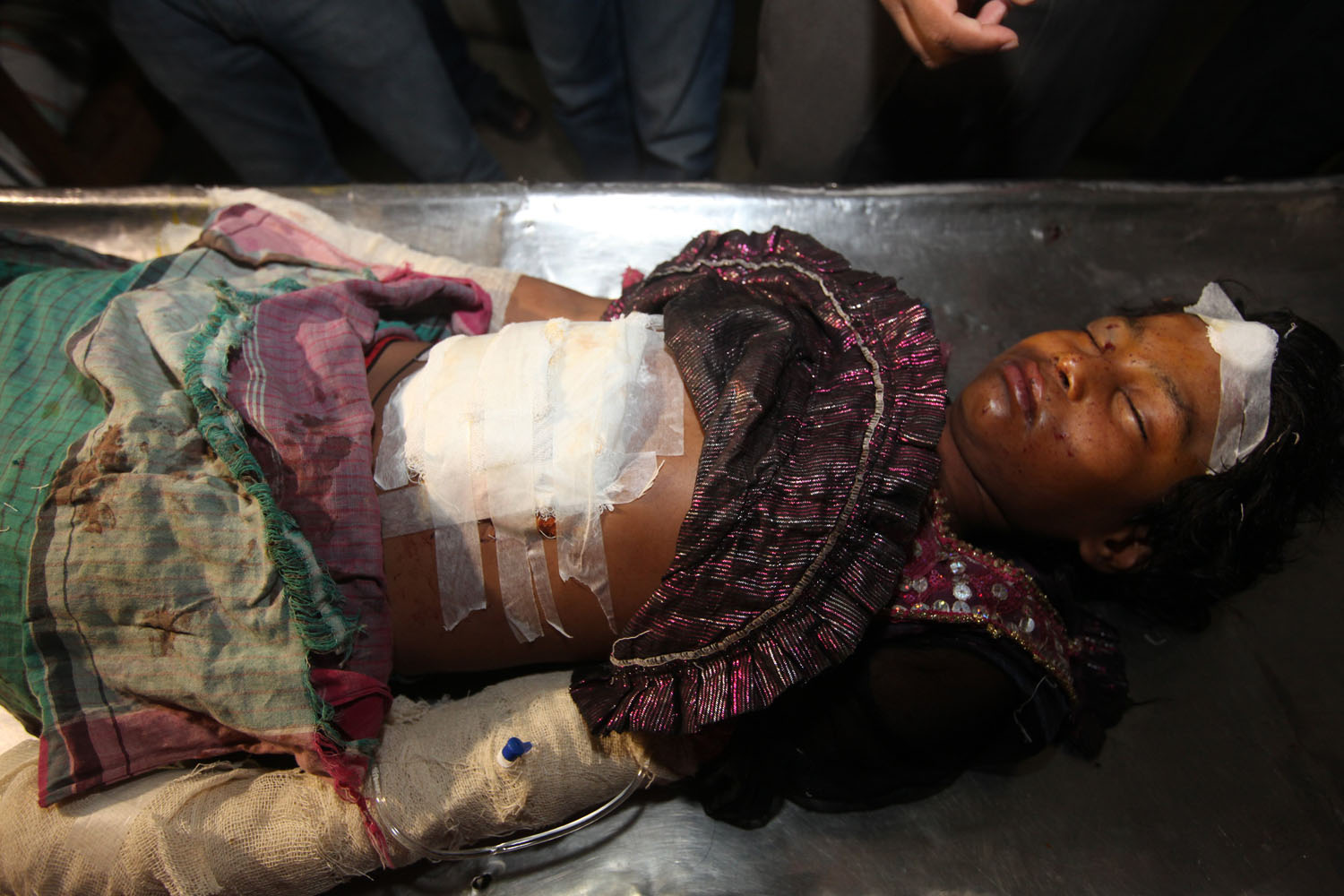 Oct. 29, 2013.  Rahima, 9, lies on a bed at the Dhaka Medical College Hospital from splinter injuries and the loss of an eye following a handmade bomb blast by the strike activists in Dhaka.