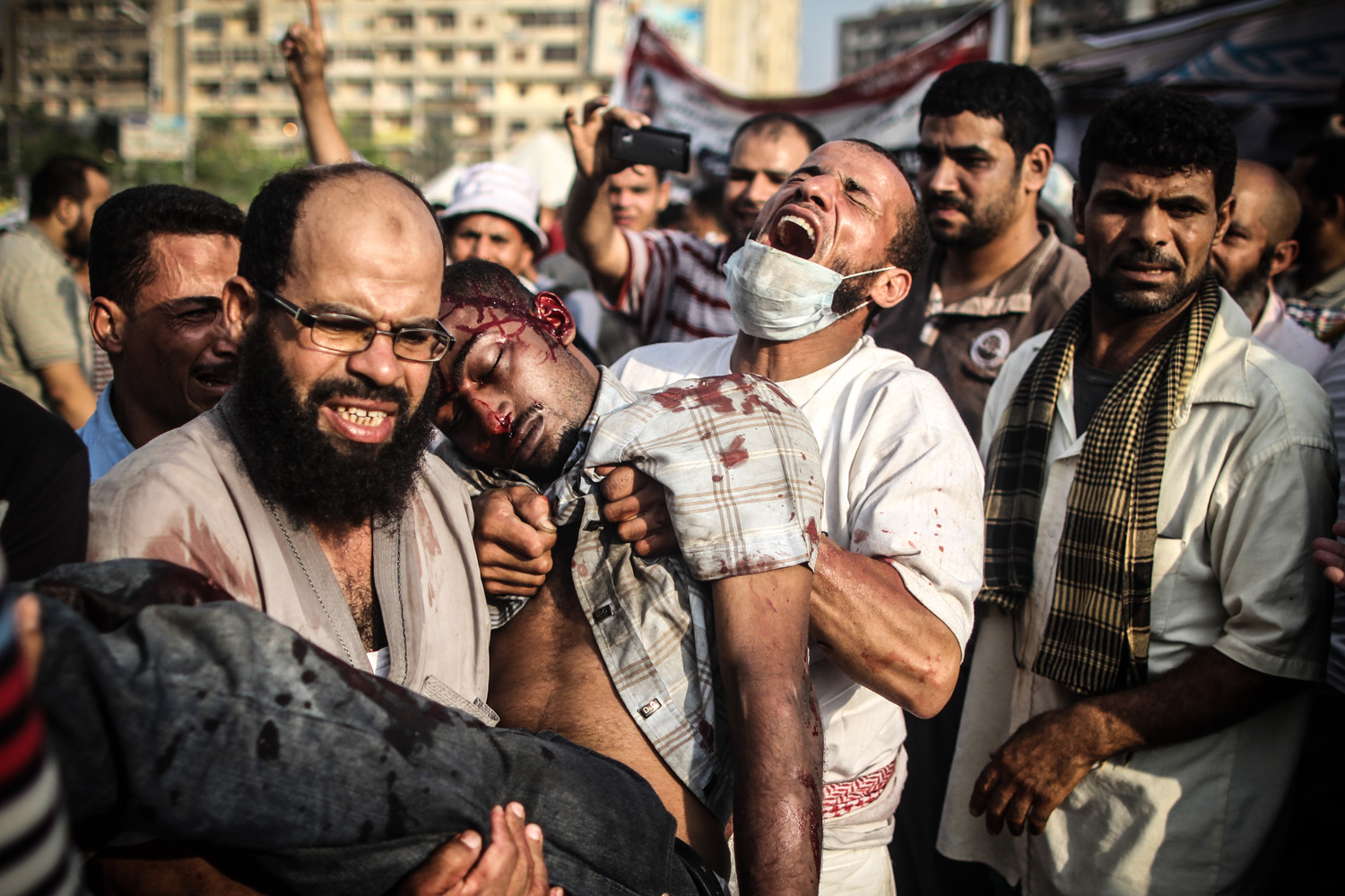 Morsi supporters scream as they carry a man shot in the head outside the makeshift hospital in Rabaa Square.