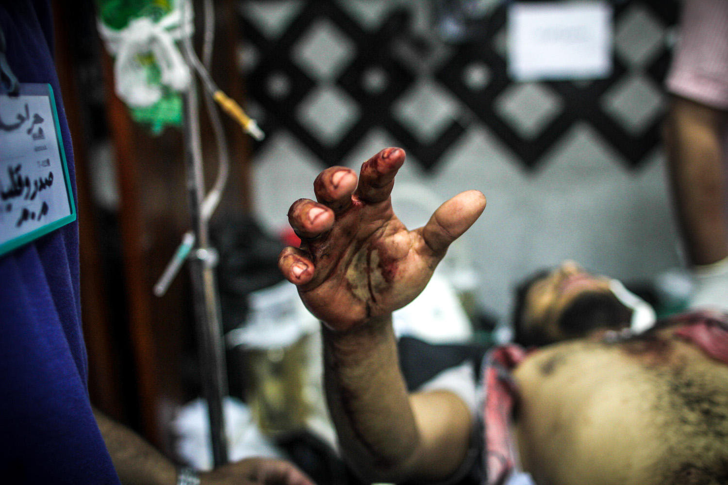 July 27, 2013. An injured supporter of ousted president Mohamed Morsi pleads for help at a makeshift hospital in Rabaa.