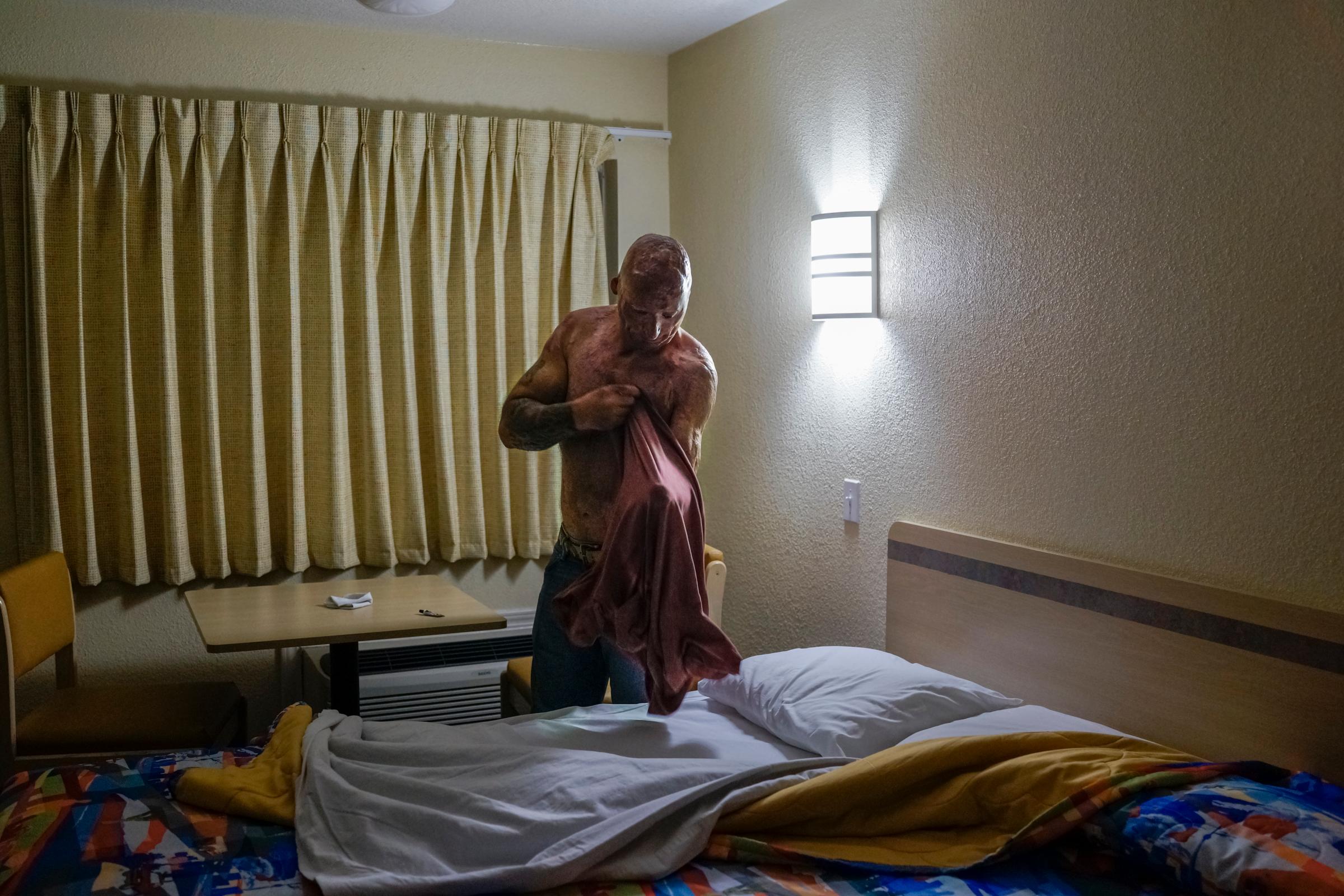 2013. Humble, TX. USA. Bobby gets ready for bed at a Motel 6. Bobby Henline, 41, veteran of four tours to Iraq and sole survivor of an IED blast that killed the other four soldiers in his humvee in Iraq in 2007. He is now a standup comedian launching a new career with a routine built around his injuries. He received burns over 38% of his body in the blast.