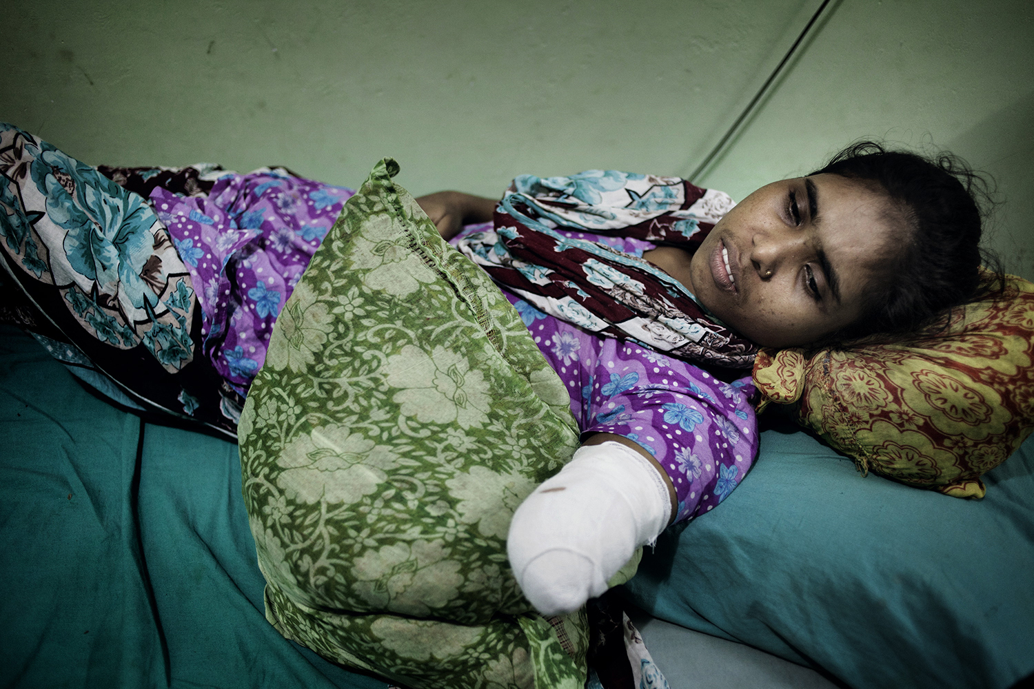 June 14, 2013. Rojina, 25, lost her arm under the rubble. To save her own life, Rojina tried to amputate it herself, Savar, Dhaka, Bangladesh.
