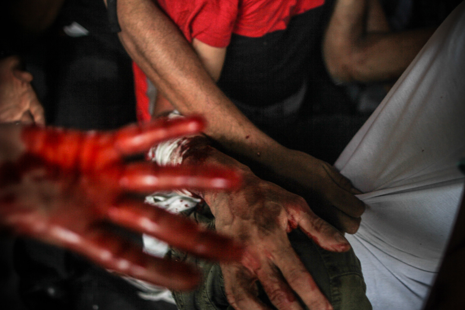 Bloodied hands are seen at Ramses square, where violent clashes broke out on the Day of Rage, the first Friday after Rabaa massacre. August 16, 2013.