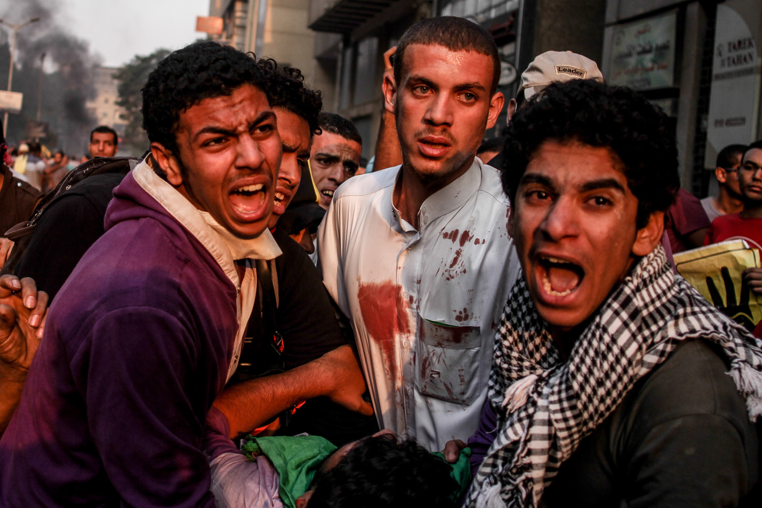 Oct. 6, 2013. An injured Egyptian supporter of ousted President Morsi is assisted during clashes on the day the country celebrates the 40th anniversary of the 1973 Arab-Israeli war, in the Dokki area of Giza, near Cairo.