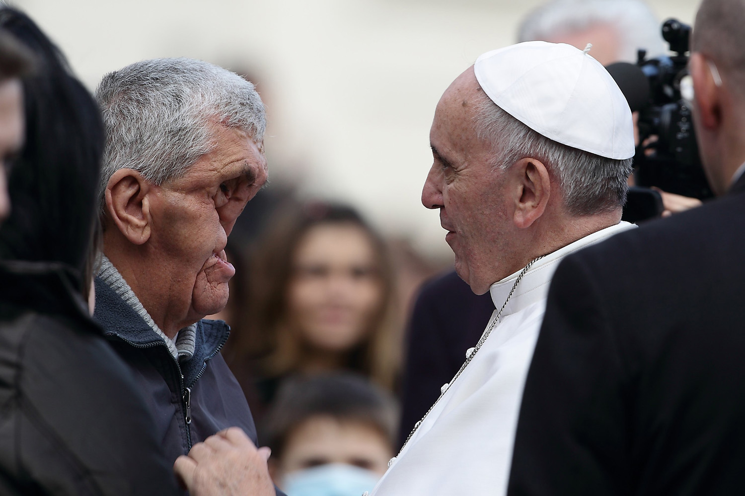 Nov. 20, 2013. Pope Francis blesses a sick man with deformed facial features after his general audience in St. Peter's Square at the Vatican.