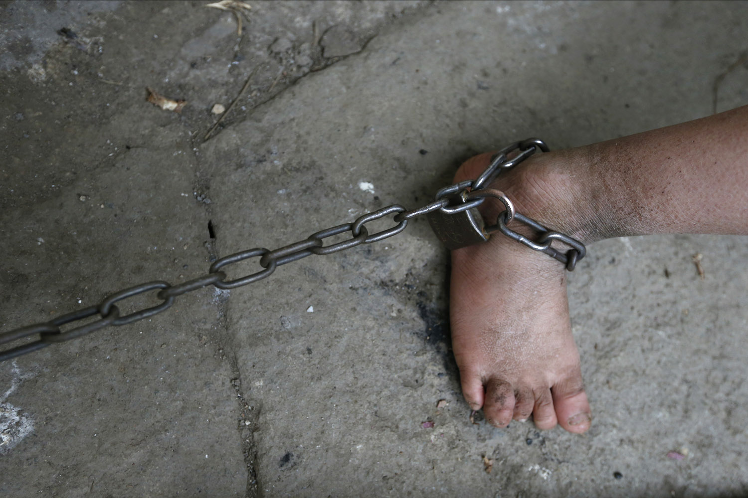 The chains around the ankle of eleven-year-old He Zili is seen in his home in Zhejiang province