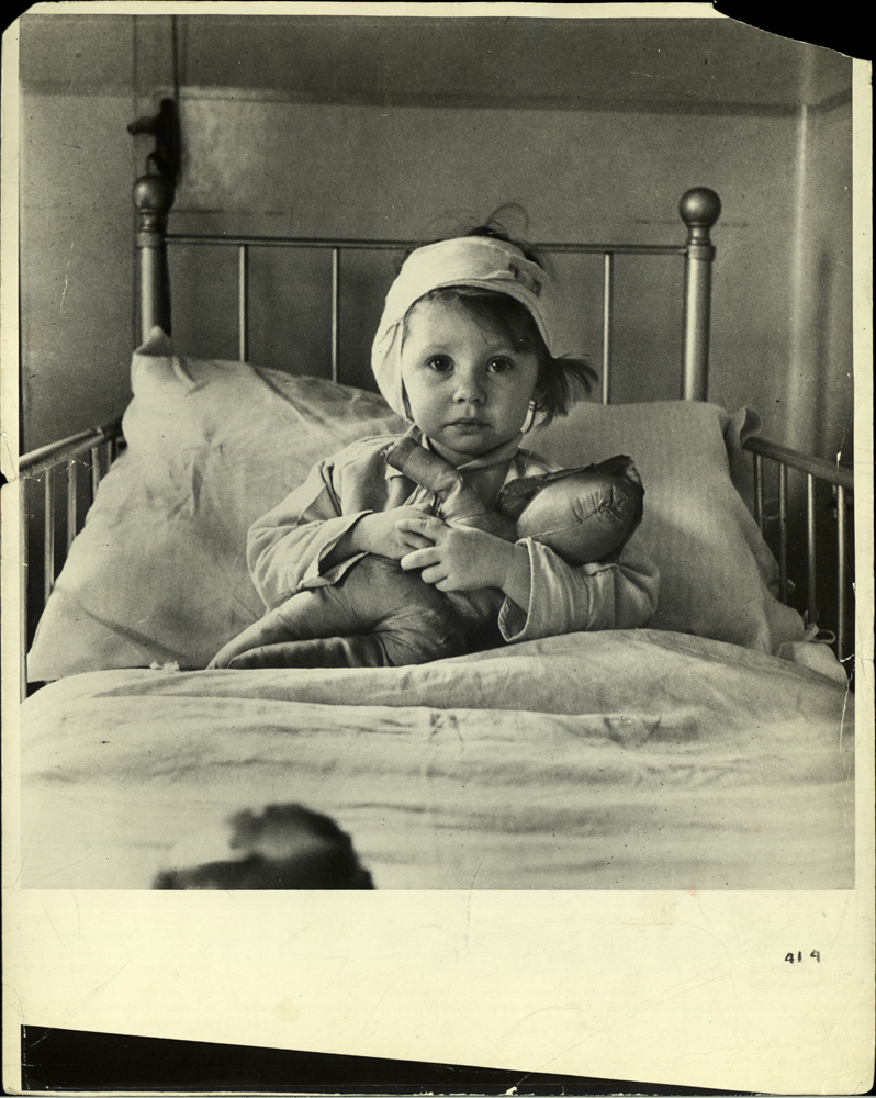Three-year-old Eileen Dunne, a victim of the London Blitz, in hospital, 1940.