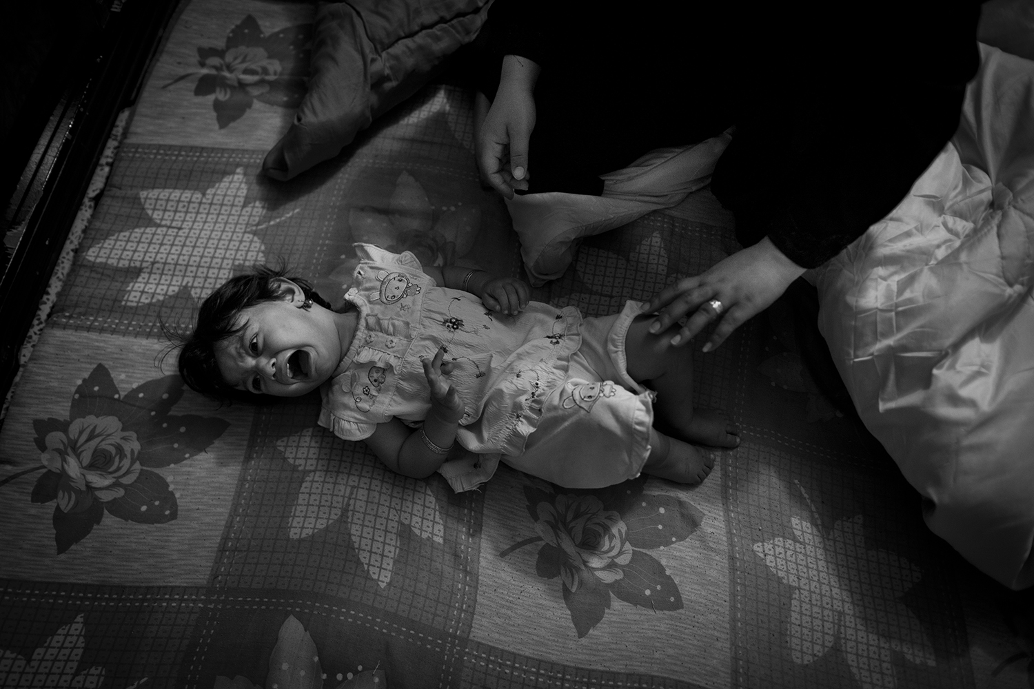 Apr. 24, 2012. Basra. An infant girl, who suffers from leukemia and two different length legs, lies on the floor in pain.