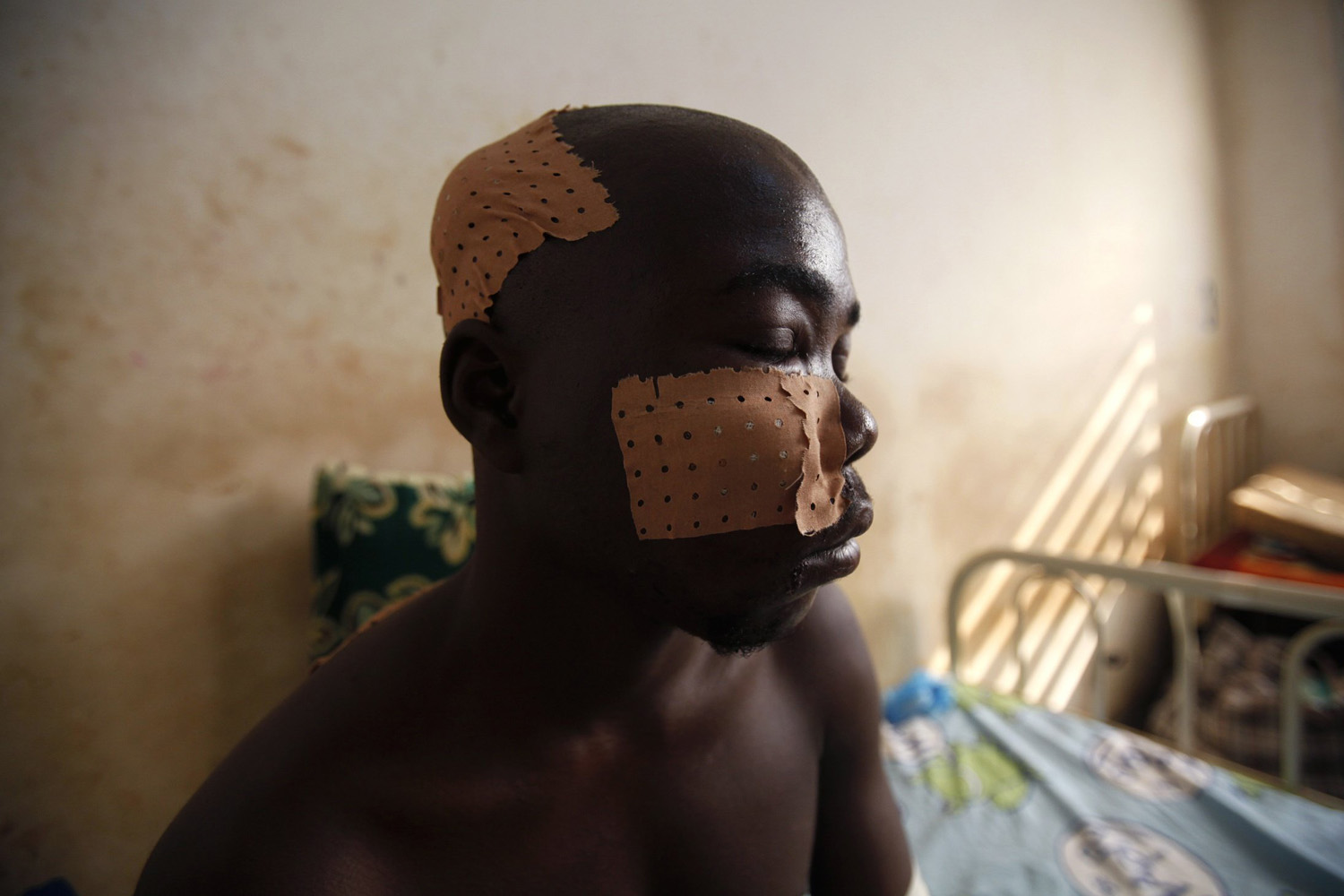 A civilian, wounded by the impact of a rocket, sits on his bed at "Hopital de l'Amitie" in Bangui
