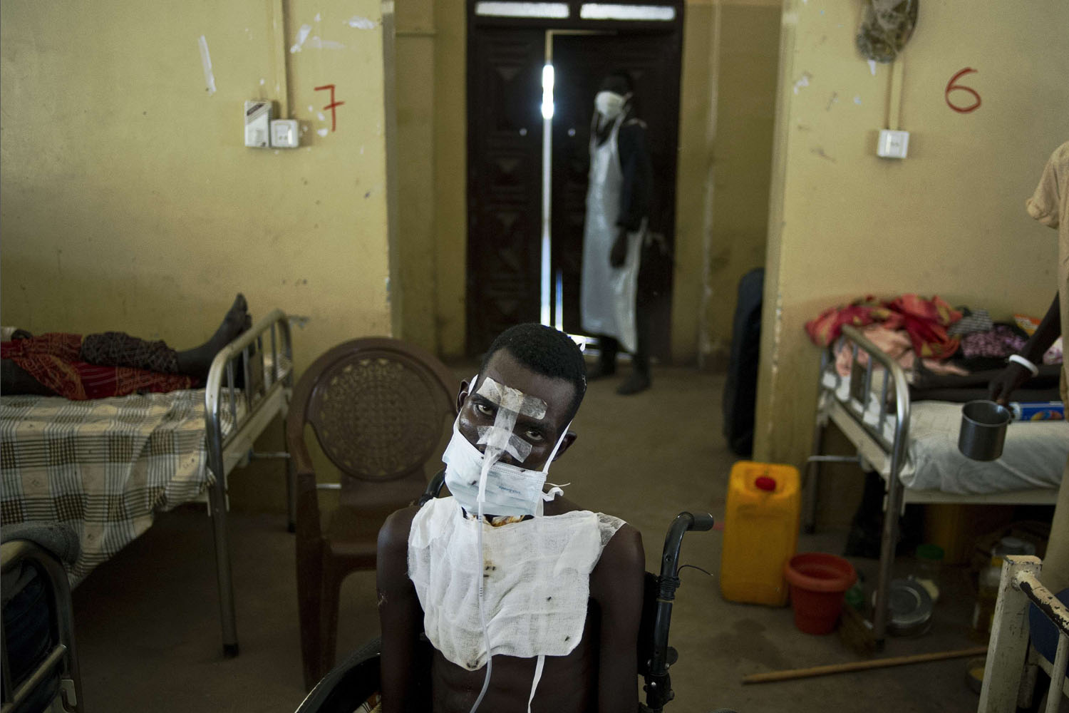 Feb. 5, 2014. A patient being treated for multiple gunshot wounds to the face, chest and throat sits in a wheelchair in the Malakal teaching hospital.