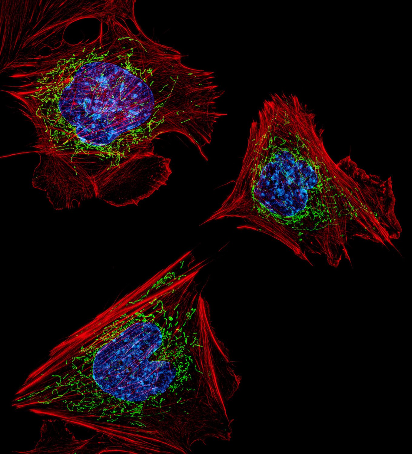 5th Place: Mouse embryonic fibroblasts showing the actin filaments (red) and DNA (blue).