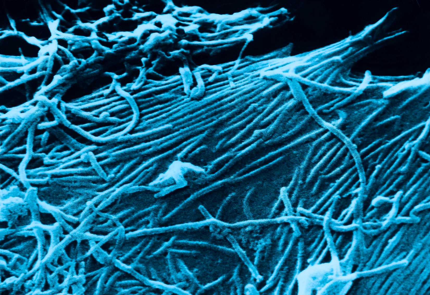 This scanning electron micrograph, SEM, depicts a number of Ebola virions. (UIG/Getty Images)