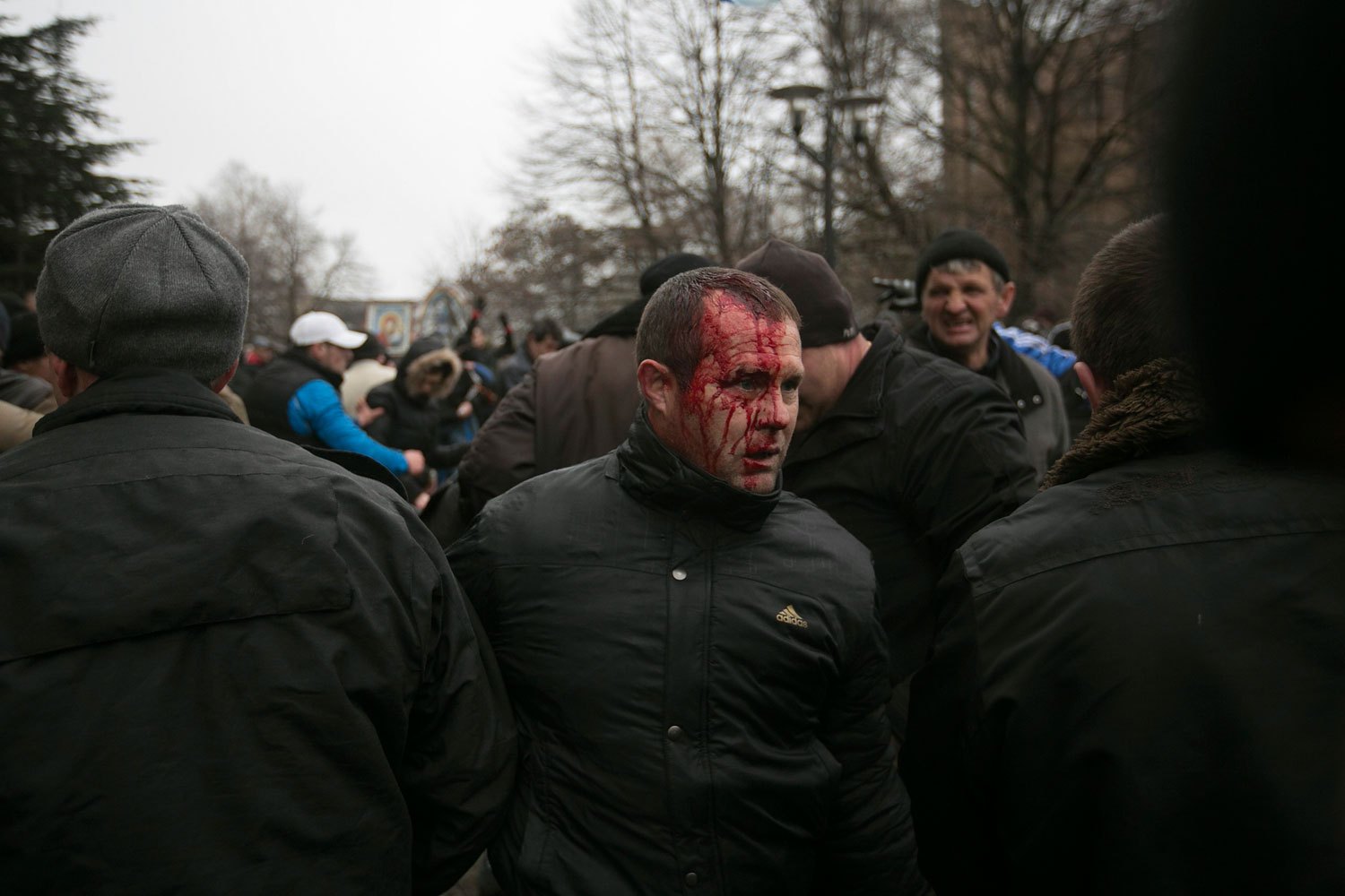 A Ukrainian man walks away after being injured in a stampede during clashes at rallies held by ethnic Russians and Crimean Tatars near the Crimean parliament building in Simferopol, Feb. 26, 2014.