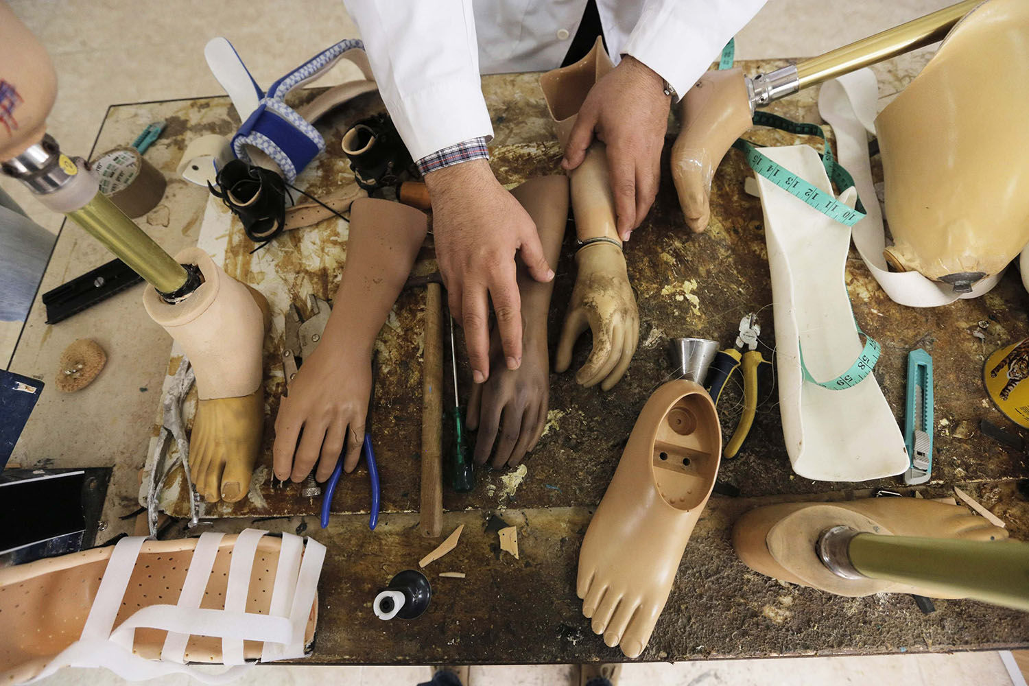 Mar. 4, 2014. A Palestinian technician works at a small factory that produces artificial limbs in the West Bank town of Qalqilya.