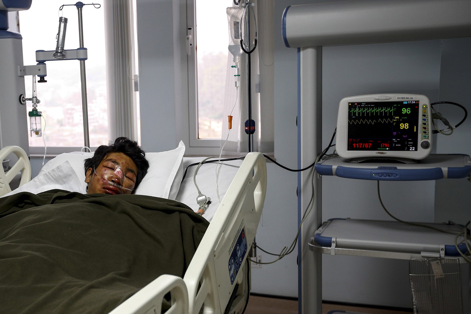 Apr. 18, 2014. Nepalese Mountaineer and Mount Everest avalanche survivor sherpa Tashi Daba is undergoing treatment at the Intensive Care Unit of Grandee Hospital in Kathmandu, Nepal.