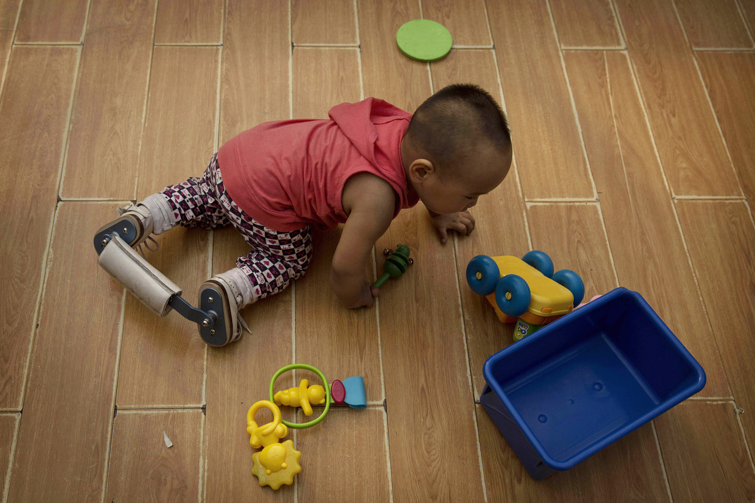 A young Chinese orphaned boy crawls wearing corrective leg braces on the floor of a foster care center on April 2, 2014 in Beijing, China. China's orphanages and foster homes used to be filled with healthy girls, reflecting the country's one-child policy and its preference for sons.Now the vast majority of orphans are sick or disabled.