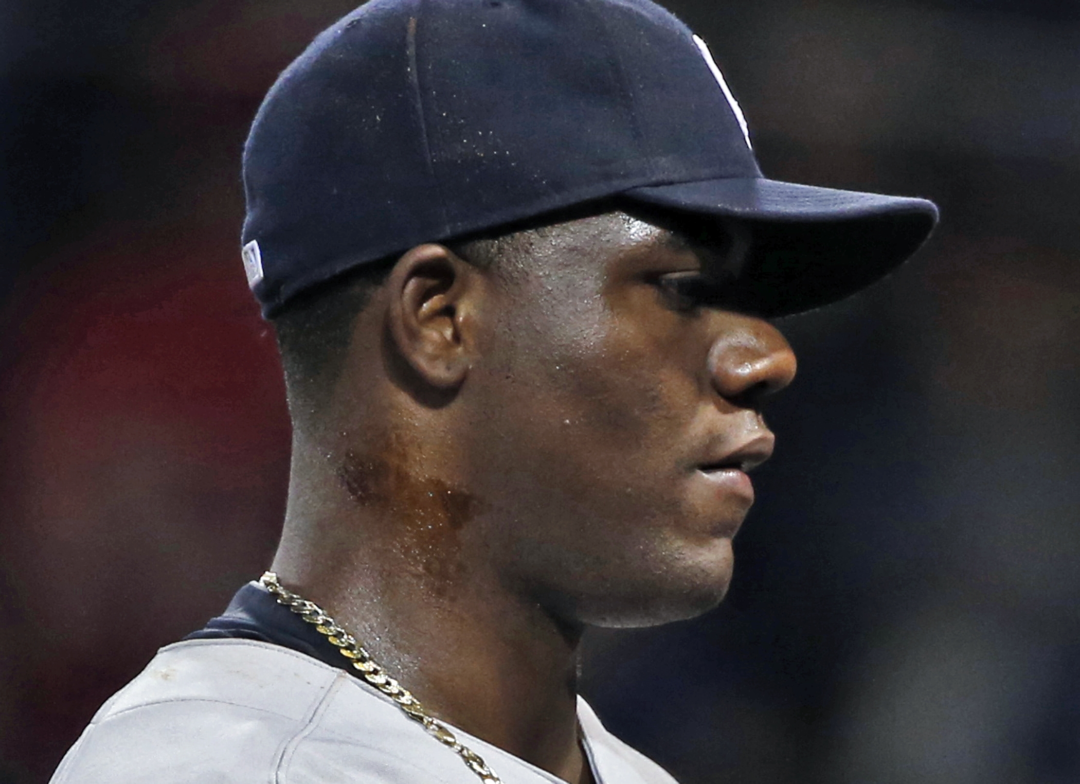 Michael Pineda Pine Tar: Yankees Pitcher Suspended 10 Games