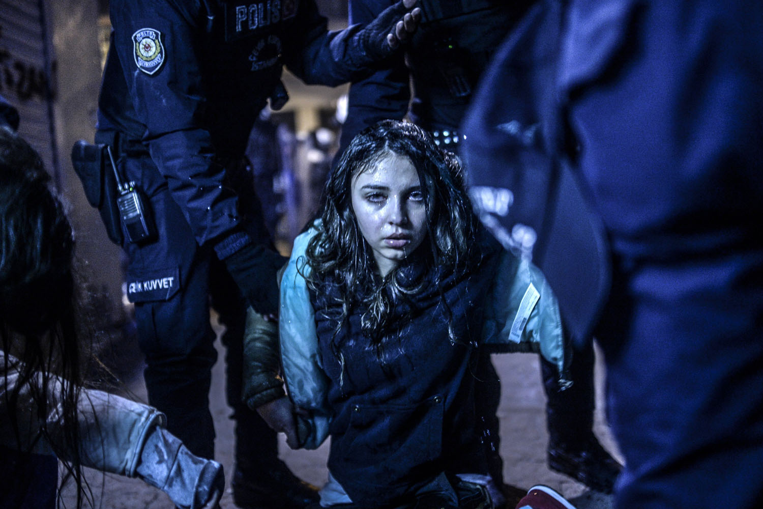 A young girl is pictured after she was wounded during clashes between riot-police and prostestors after the funeral of Berkin Elvan, the 15-year-old boy who died from injuries suffered during last year's anti-government protests, in Istanbul on March 12, 2014.