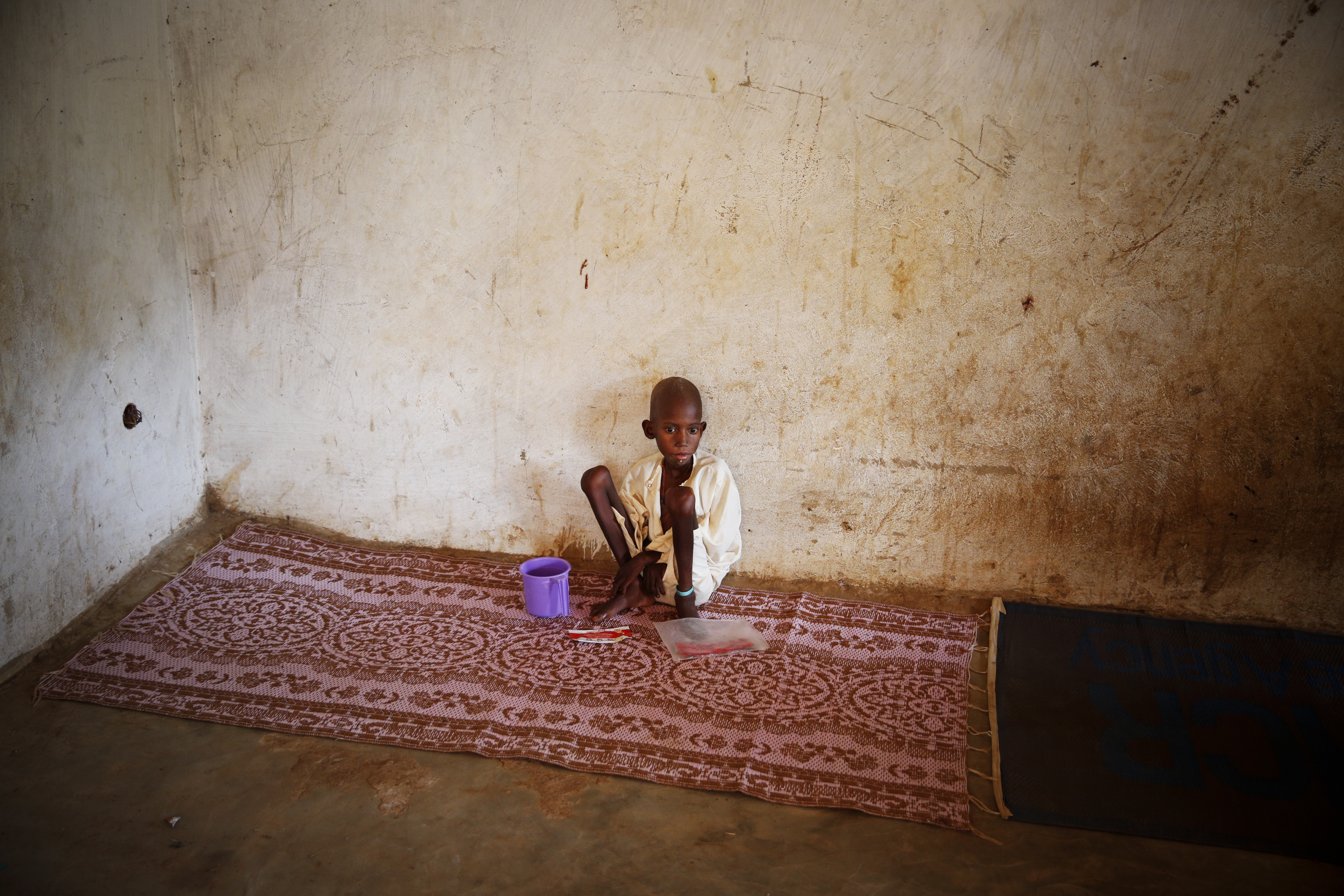 Mar. 27, 2014. A young Peuhl boy named Zakaria, who suffers from malnutrition and was brought to the pediatric center, is among the Muslims who have taken refuge at the mosque in the Muslim enclave of Begoua.