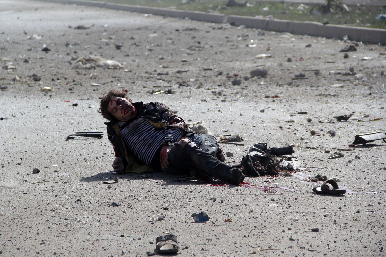 Apr. 2, 2014. 
                              An injured man is seen on the ground following a reported air strike by government forces  in the Sakhur neighborhood in the northern Syrian city of Aleppo.