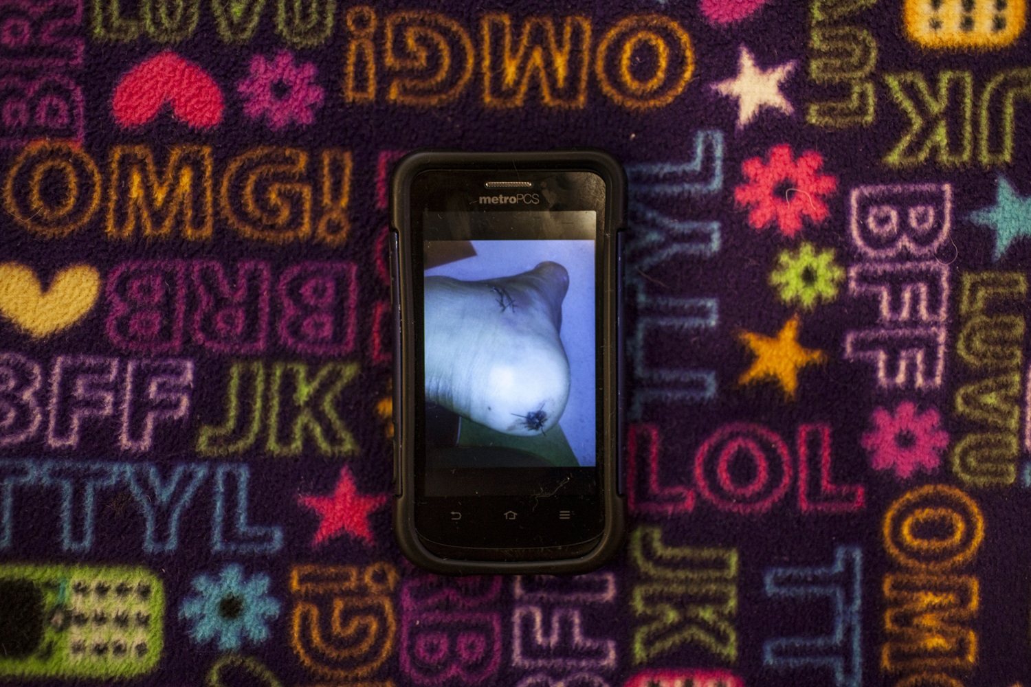 December 31, 2013. Sarah's cell phone sits on her text-message themed bed spread. On the phone is a photo she took of her swollen foot immediately after the bullet was removed. The bullet entered through the back of her heel and had to be removed through an incision in the side of her foot.