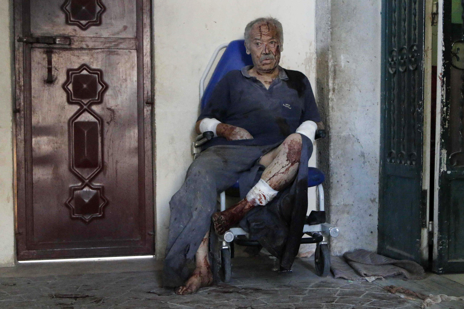 An injured man waits for medical attention after, according to activists, two barrel bombs were thrown by forces loyal to Syria's president Bashar Al-Assad in Aleppo