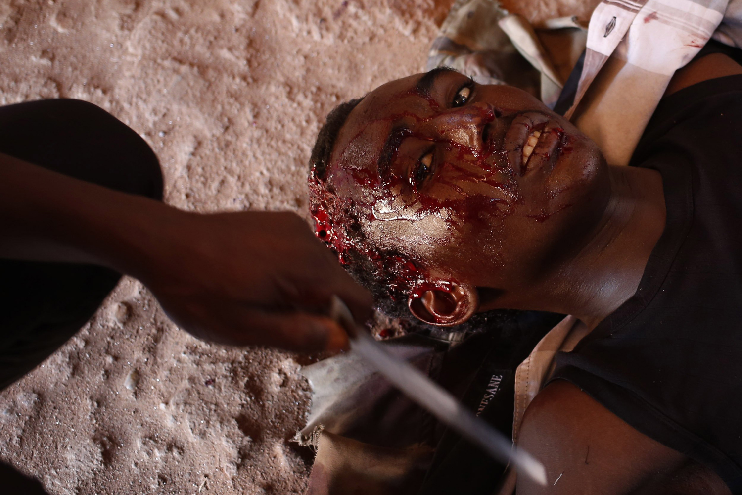 A Seleka fighter injured by a mortar shell fired by French soldiers lies in Bambari